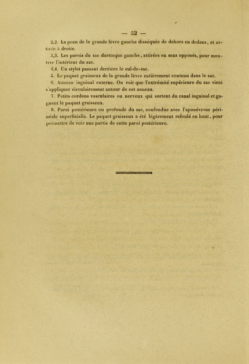 2.2. La peau de la grande lèvre gauche disséquée de dehors en dedans, et at- tirée à droite. 3.3. Les parois du sac dartoïque gauche, attirées en sens opposés, pour mon- trer l’intérieur du sac. 5.4. Un stylet passant derrière le cul-de-sac. 5. Le paquet graisseux de la grande lèvre entièrement contenu dans le sac. G. Amieau inguinal externe. On voit que l’extrémité supérieure du sac vient s’appliquer circulairement autour de cet anneau. 7. Petits cordons vasculaires ou nerveux qui sortent du canal inguinal et ga- gnent le paquet graisseux. 8. Paroi postérieure ou profonde du sac, confondue avec l’aponévrose péri- néale superficielle. Le paquet graisseux a été légèrement refoulé en haut, pour permettre de voir une partie de cette paroi postérieure.