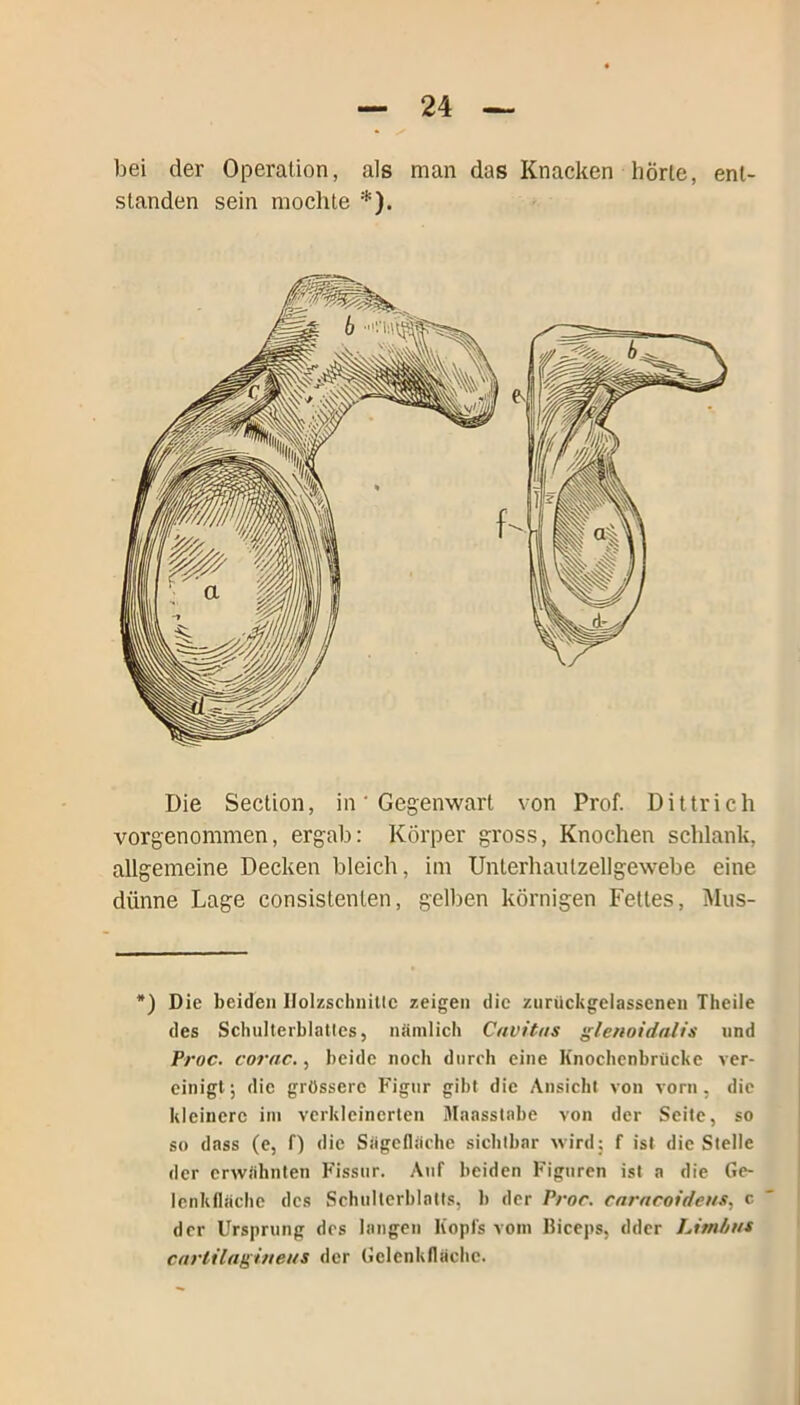 bei der Operation, als man das Knacken hörte, ent- standen sein mochte *). Die Section, in ‘ Gegenwart von Prof. Dittrich vorgenommen, ergab: Körper gross, Knochen schlank, allgemeine Decken bleich, im Unterhautzellgewebe eine dünne Lage consistenlen, gelben körnigen Fettes, Mus- *) Die beiden Holzschnitte zeigen die zuruckgelassenen Theile des Schulterblattes, nämlich Cnvitus glenoidalis und Proc. corac., beide noch durch eine Knochenbriickc ver- einigt ; die grössere Figur gibt die Ansicht von vorn, die kleinere im verkleinerten Maasstabe von der Seite, so so dass (e, P) die Sägefliiche sichtbar wird; f ist die Stelle der erwähnten Fissur. Auf beiden Figuren ist a die Ge- lenkfläche des Schulterblatts, b der Proc. carncoideus, c der Ursprung dos langen Kopfs vom Biceps, dder Limhus cnrlilagineus der Gelenkfläche.