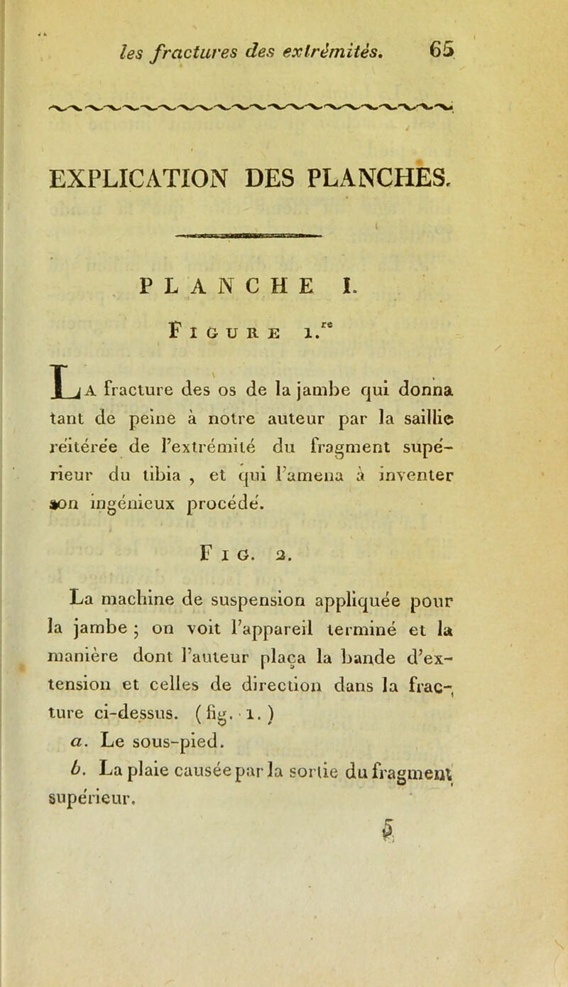 EXPLICATION DES PLANCHES, PLANCHE I. Figure i.“ T M fracture des os de la jambe qui donna tant de peine à notre auteur par la saillie reitérée de l’extrémité du fragment supé- rieur du tibia , et qui l'amena à inventer son ingénieux procédé. Fig. 2. La machine de suspension appliquée pour la jambe ; on voit l’appareil terminé et la manière dont l’auteur plaça la bande d’ex- tension et celles de direction dans la frac- ture ci-dessus. ( fig. 1. ) a. Le sous-pied. b. La plaie causée par la sortie du fragment supérieur.