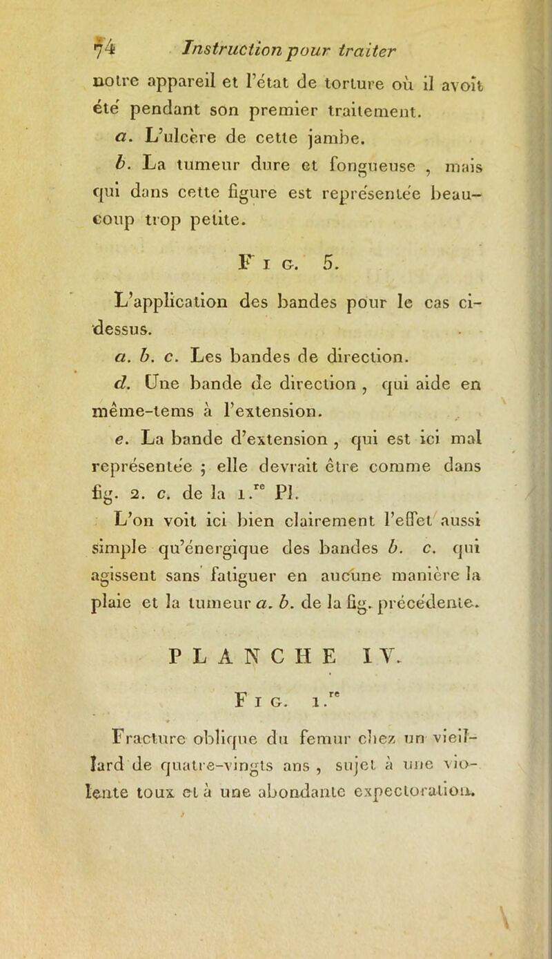 notre appareil et l’état de torture où il avoît été pendant son premier traitement. a. L’ulcère de cette jambe. b. La tumeur dure et fongueuse , mais qui dans cette figure est représentée beau- coup trop petite. F i g. 5. L’application des bandes pour le cas ci- dessus. a. b. c. Les bandes de direction. d. Une bande de direction , qui aide en même-tems à l’extension. e. La bande d’extension , qui est ici mal représentée ; elle devrait être comme dans fig. 2. c. de la i.re PI. L’on voit ici bien clairement l'effet aussi simple qu’énergique des bandes b. c. qui agissent sans fatiguer en aucune manière la plaie et la tumeur a. b. de la fig. précédente. PLANCHE 1 Y. F T G. l.rB Fracture oblique du fémur chez un vieil- lard de quatre-vingts ans , sujet à une vio- lente toux et à une abondante expectoration.