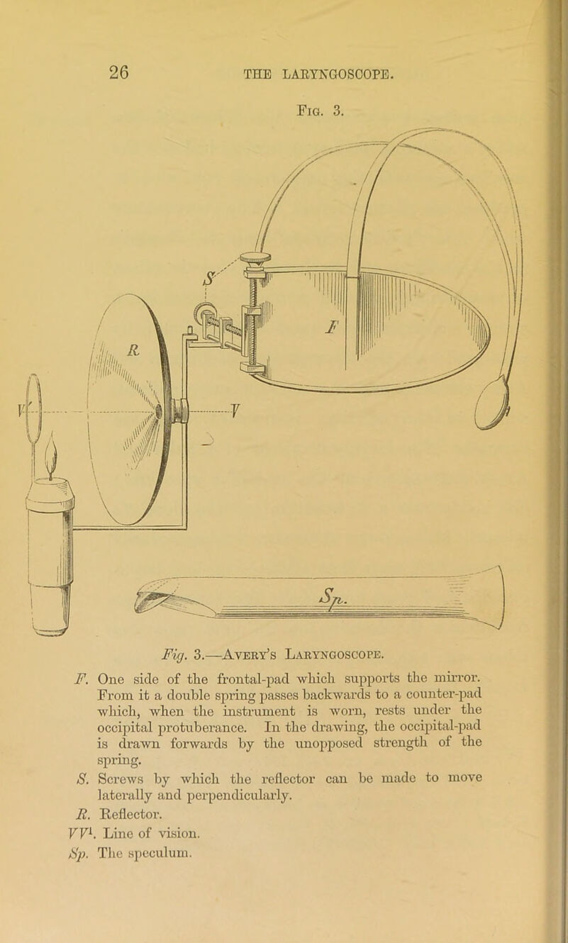 Fig. 3. Fig. 3.—Avery’s Laryngoscope. F. One side of the frontal-pad which supports the mirror. From it a double spring passes backwards to a counter-pad which, when the instrument is worn, rests under the occipital protuberance. In the drawing, the occipital-pad is drawn forwards by the unopposed strength of the spring. S. Screws by which the reflector can be made to move laterally and perpendicularly. Ii. Reflector. VVl. Line of vision. Sp. The speculum.