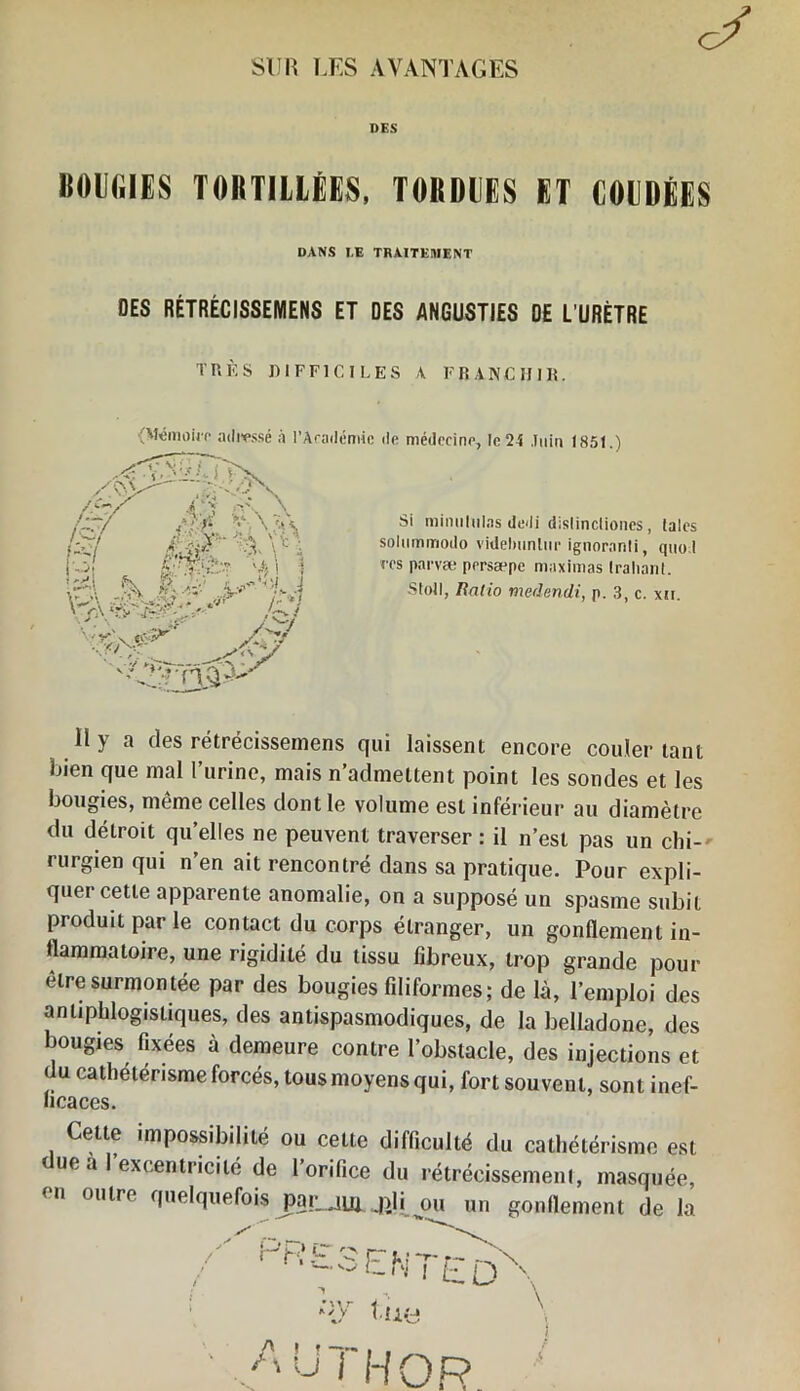 SUR UES AVANTAGES DES BOUGIES TORTILLÉES, TORDUES ET COUDÉES DANS T.E TRAITEMENT DES RÉTRÉCISSEMENS ET DES ANGUSTIES DE L’URÈTRE TRÈS DIFFICILES A FRANCHIR. (Mémoh'o adressé à l'Académie île médecine, le 24 Juin 1851.) Si mimiltilas dedi dislincliones, laies soliiminodo videlmnlnr ignoranli, quoi ees parvæ persæpe maximas Irahanl. Stoll, Ratio medendi, p. 3, c. xn. II y a des rétrécissemens qui laissent encore couler tant îjien que mal l’urine, mais n’admettent point les sondes et les bougies, même celles dont le volume est inférieur au diamètre du détroit qu’elles ne peuvent traverser : il n’est pas un chi- rurgien qui n’en ait rencontré dans sa pratique. Pour expli- quer cette apparente anomalie, on a supposé un spasme subit produit par le contact du corps étranger, un gonflement in- flammatoire, une rigidité du tissu fibreux, trop grande pour elre surmontée par des bougies filiformes; de là, l’emploi des antiphlogistiques, des antispasmodiques, de la belladone, des bougies fixées à demeure contre l’obstacle, des injections et (lu cathétérisme forcés, tous moyens qui, fort souvent, sont inef- ficaces. Cette impossibilité ou cette difficulté du cathétérisme esi ue a 1 excentricité de l’orifice du rétrécissement, masquée, (u outre quelquefois jrar jpp j)lj ou un gonflement de la /PR £ 3 P k\ 7- r- — l—l'j l /-• / ) V, 1 ^ \ tue