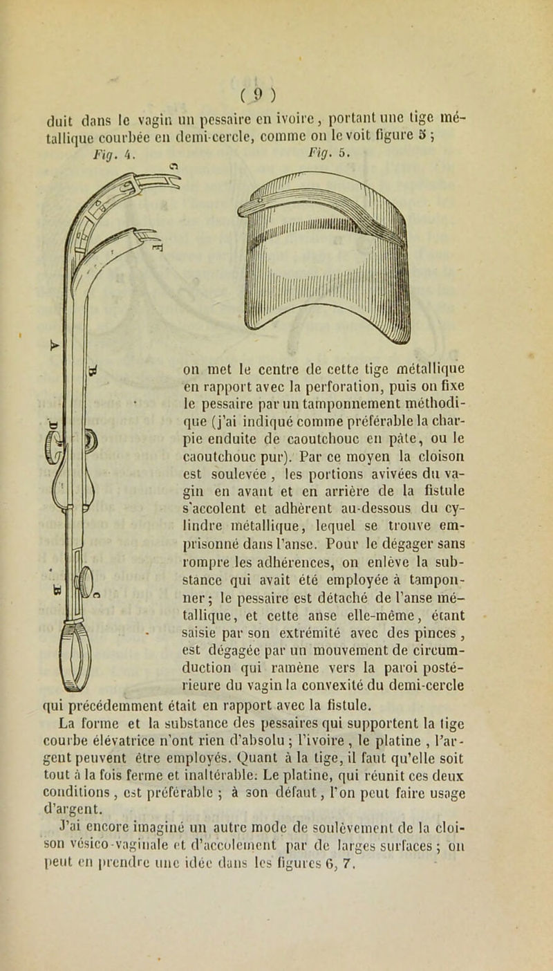 duit dans le vagin un pessaire en ivoire, portant une lige mé- tallique courbée en demi-cercle, comme on le voit figure £> ; Fig. 4. es Fig. 5. on met le centre de cette tige métallique en rapport avec la perforation, puis on fixe le pessaire par un tamponnement méthodi- que (j’ai indiqué comme préférable la char- pie enduite de caoutchouc en pâte, ou le caoutchouc pur). Par ce moyen la cloison est soulevée , les portions avivées du va- gin en avant et en arrière de la fistule s'accolent et adhèrent au-dessous du cy- lindre métallique, lequel se trouve em- prisonné dans l’anse. Pour le dégager sans rompre les adhérences, on enlève la sub- stance qui avait été employée à tampon- ner ; le pessaire est détaché de l’anse mé- tallique, et cette anse elle-même, écant saisie par son extrémité avec des pinces , est dégagée par un mouvement de circum- duction qui ramène vers la paroi posté- rieure du vagin la convexité du demi-cercle qui précédemment était en rapport avec la fistule. La forme et la substance des pessaires qui supportent la lige courbe élévatrice n’ont rien d’absolu ; l’ivoire , le platine , l’ar- gent peuvent être employés. Quant à la tige, il faut qu’elle soit tout à la fois ferme et inaltérable: Le platine, qui réunit ces deux conditions, est préférable ; à son défaut, l’on peut faire usage d’argent. J’ai encore imaginé un autre mode de soulèvement de la cloi- son vésico-vaginale et d’accoleincnt par de larges surfaces ; on peut en prendre une idée dans les figures 6, 7.