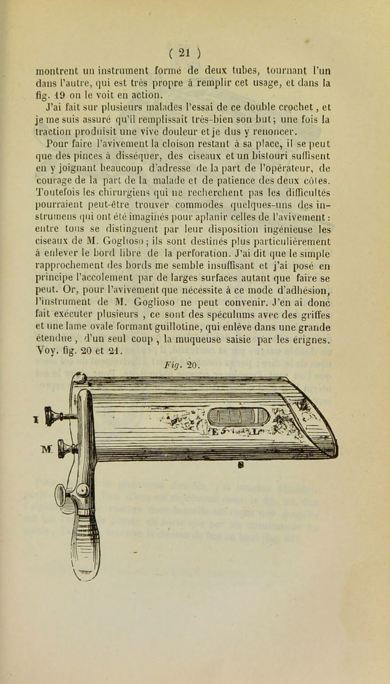 montrent un instrument formé de deux tubes, tournant l’un dans l’autre, qui est très propre à remplir cet usage, et dans la fig. 19 on le voit en action. J’ai fait sur plusieurs malades l’essai de ce double crochet, et je me suis assuré qu’il remplissait très-bien son but; une fois la traction produisit une vive douleur et je dus y renoncer. Pour faire l’avivement la cloison restant à sa place, il se peut que des pinces à disséquer, des ciseaux et un bistouri suffisent en y joignant beaucoup d’adresse de la part de l’opérateur, de courage de la part de la malade et de patience des deux côtes. Toutefois les chirurgiens qui ne recherchent pas les difficultés pourraient peut-être trouver commodes quelques-uns des in- strumens qui ont été imaginés pour aplanir celles de l’avivement : entre tous se distinguent par leur disposition ingénieuse les ciseaux de M. Goghoso; ils sont destinés plus particulièrement à enlever le bord libre de la perforation. J’ai dit que le simple rapprochement des bords me semble insuffisant et j’ai posé en principe Paccolement par de larges surfaces autant que faire se peut. Or, pour l’avivement que nécessite à ce mode d’adhésion, l’instrument de M. Goglioso ne peut convenir. J’en ai donc fait exécuter plusieurs , ce sont des spéculums avec des griffes et une lame ovale formant guillotine, qui enlève dans une grande étendue , d’un seul coup , la muqueuse saisie par les érignes. Yoy. fig. 20 et 21.