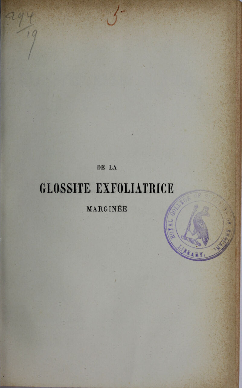 GLOSSITE EXFOLIATRICE MARGINÉE