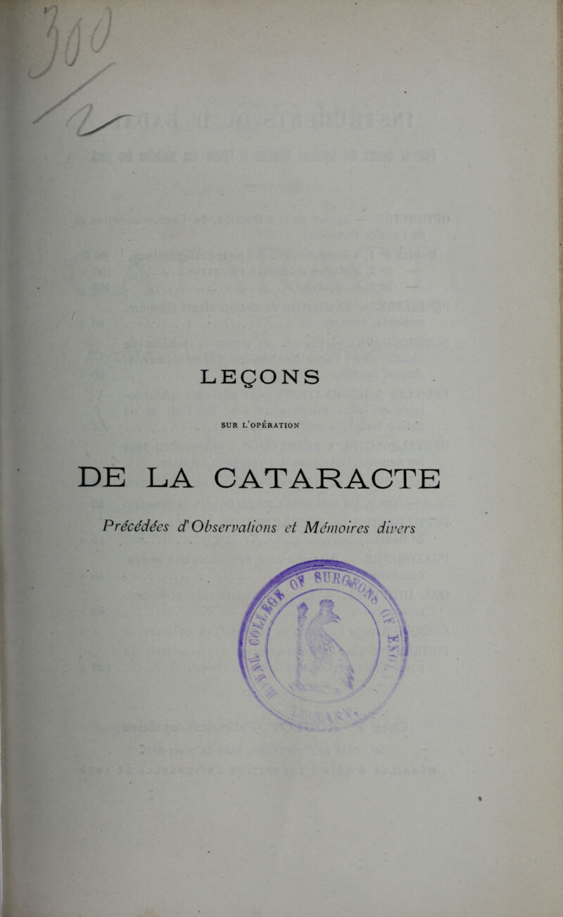 LEÇONS SUR l’opération DE LA CATARACTE Précédées d Observaiions et Mémoires divers 1