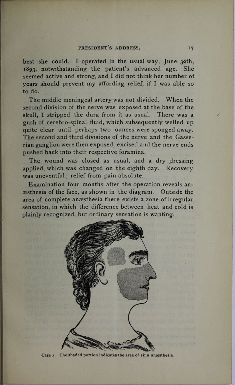 best she could. I operated in the usual way, June 30th, 1893, notwithstanding the patient’s advanced age. She seemed active and strong, and I did not think her number of years should prevent my affording relief, if I was able so to do. The middle meningeal artery was not divided. When the second division of the nerve was exposed at the base of the skull, 1 stripped the dura from it as usual. There was a gush of cerebro-spinal fluid, which subsequently welled up quite clear until perhaps two ounces were sponged away. The second and third divisions of the nerve and the Gasse- rian ganglion were then exposed, excised and the nerve ends pushed back into their respective foramina. The wound was closed as usual, and a dry dressing applied, which was changed on the eighth day. Recovery was uneventful; relief from pain absolute. Examination four months after the operation reveals an- aesthesia of the face, as shown in the diagram. Outside the area of complete anaesthesia there exists a zone of irregular sensation, in which the difference between heat and cold is plainly recognized, but ordinary sensation is wanting. Case 3. The shaded portion indicates the area of skin anaesthesia.