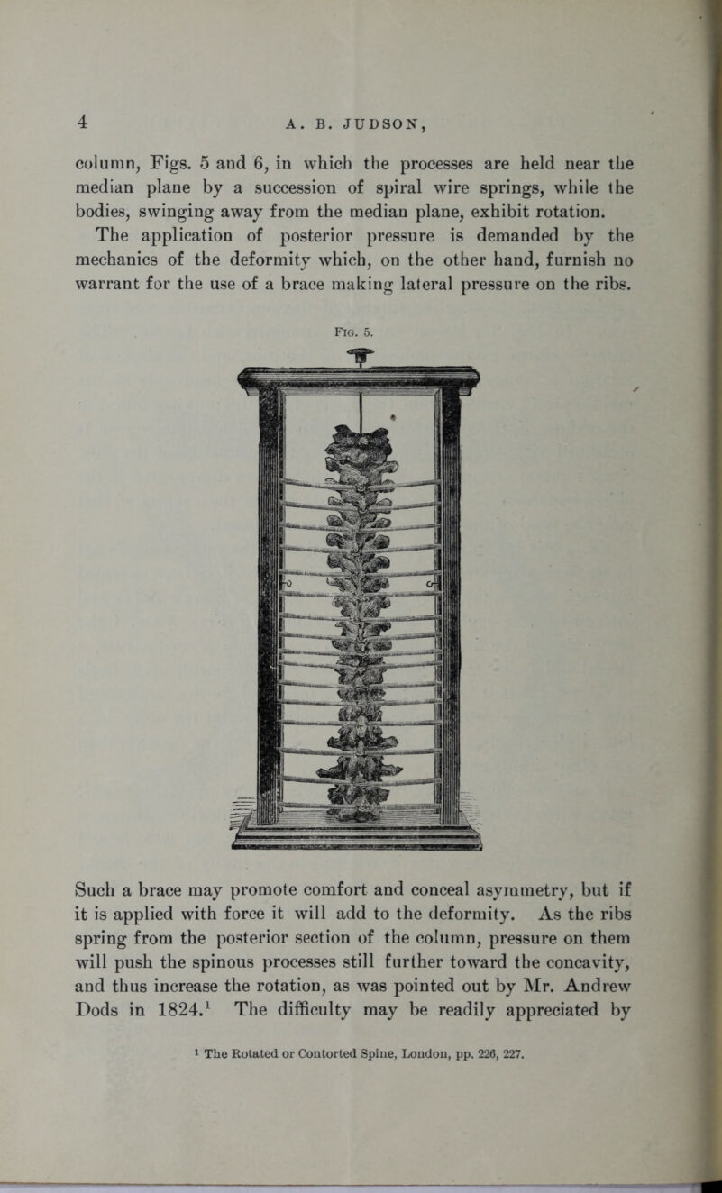 column, Figs. 5 and 6, in which the processes are held near the median plane by a succession of spiral wire springs, while the bodies, swinging away from the median plane, exhibit rotation. The application of posterior pressure is demanded by the mechanics of the deformity which, on the other hand, furnish no warrant for the use of a brace making lateral pressure on the ribs. Fig. 5. Such a brace may promote comfort and conceal asymmetry, but if it is applied with force it will add to the deformity. As the ribs spring from the posterior section of the column, pressure on them will push the spinous processes still further toward the concavity, and thus increase the rotation, as was pointed out by Mr. Andrew Dods in 1824.1 The difficulty may be readily appreciated by 1 The Rotated or Contorted Spine, London, pp. 226, 227.