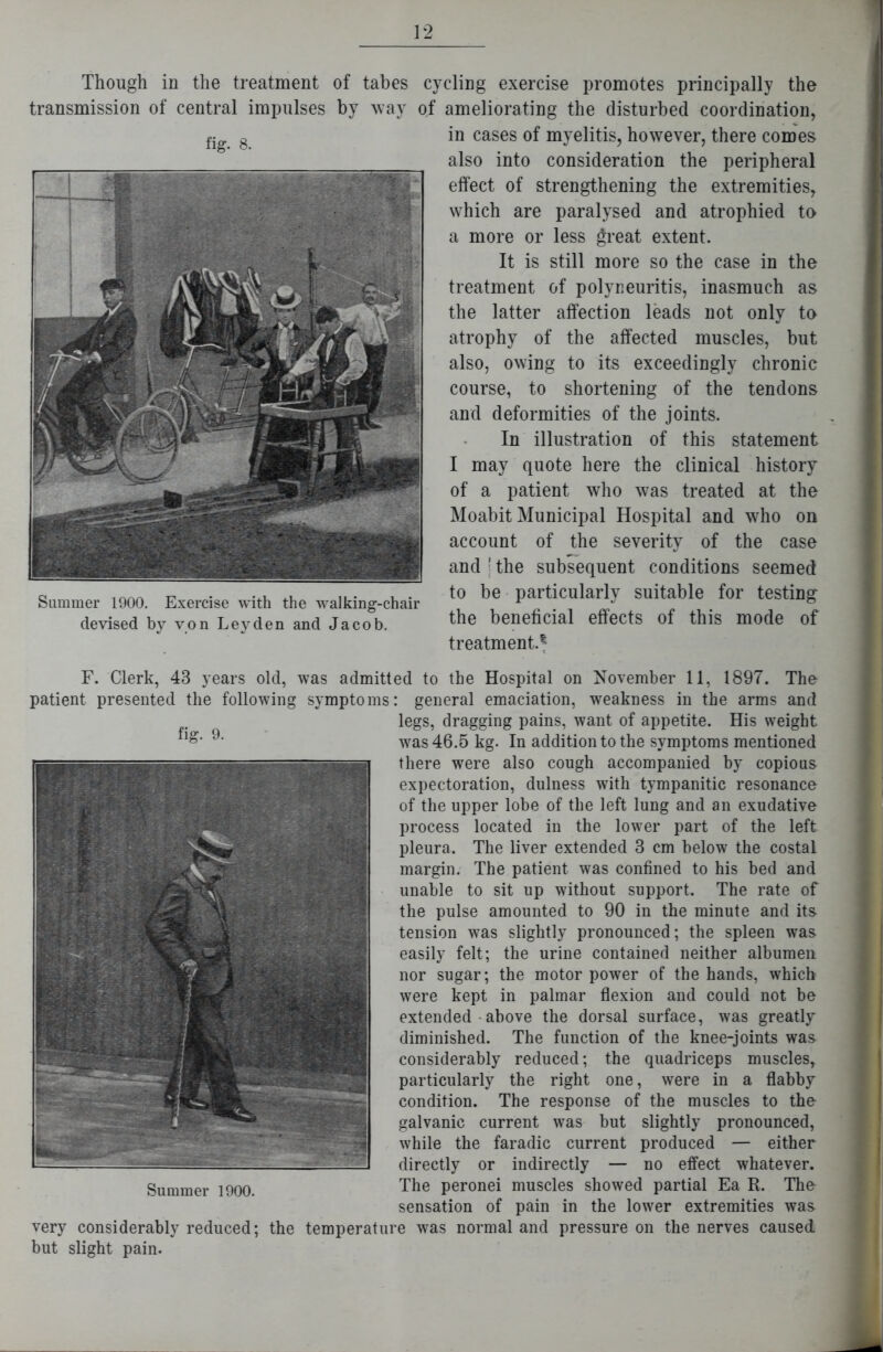 fig. 9. F. Clerk, 43 years old, was admitted to the Hospital on November 11, 1897. The patient presented the following symptoms: general emaciation, weakness in the arms and legs, dragging pains, want of appetite. His weight was 46.5 kg. In addition to the symptoms mentioned there were also cough accompanied by copious expectoration, dulness with tympanitic resonance of the upper lobe of the left lung and an exudative process located in the lower part of the left pleura. The liver extended 3 cm below the costal margin. The patient was confined to his bed and unable to sit up without support. The rate of the pulse amounted to 90 in the minute and its tension was slightly pronounced; the spleen was easily felt; the urine contained neither albumen nor sugar; the motor power of the hands, which were kept in palmar flexion and could not be extended above the dorsal surface, was greatly diminished. The function of the knee-joints was considerably reduced; the quadriceps muscles, particularly the right one, were in a flabby condition. The response of the muscles to the galvanic current was but slightly pronounced, while the faradic current produced — either directly or indirectly — no effect whatever. The peronei muscles showed partial Ea R. The sensation of pain in the lower extremities was very considerably reduced; the temperature was normal and pressure on the nerves caused but slight pain. Summer 1900. Though in the treatment of tabes cycling exercise promotes principally the transmission of central impulses by way of ameliorating the disturbed coordination, fig. 8. Summer 1900. Exercise with the walking-chair devised by von Leyden and Jacob. in cases of myelitis, however, there comes also into consideration the peripheral effect of strengthening the extremities, which are paralysed and atrophied to a more or less great extent. It is still more so the case in the treatment of polyneuritis, inasmuch as the latter affection leads not only to atrophy of the affected muscles, but also, owing to its exceedingly chronic course, to shortening of the tendons and deformities of the joints. In illustration of this statement I may quote here the clinical history of a patient who was treated at the Moabit Municipal Hospital and who on account of the severity of the case and j the subsequent conditions seemed to be particularly suitable for testing the beneficial effects of this mode of treatment.1