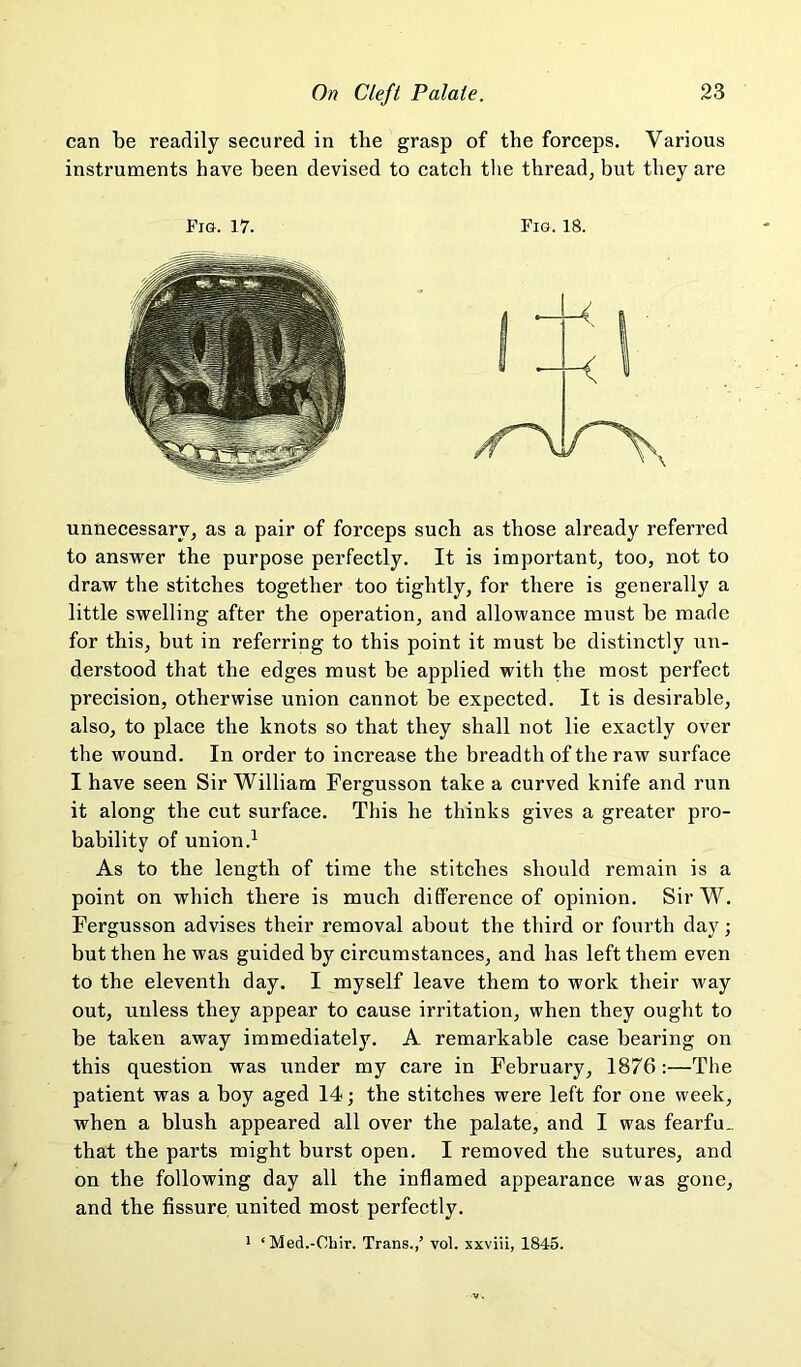 can be readily secured in the grasp of the forceps. Various instruments have been devised to catch tlie thread, but they are Fi&. 17. Fig. 18. unnecessary, as a pair of forceps such as those already referred to answer the purpose perfectly. It is important, too, not to draw the stitches together too tightly, for there is generally a little swelling after the operation, and allowance must be made for this, but in referring to this point it must be distinctly un- derstood that the edges must be applied with the most perfect precision, otherwise union cannot be expected. It is desirable, also, to place the knots so that they shall not lie exactly over the wound. In order to increase the breadth of the raw surface I have seen Sir William Fergusson take a curved knife and run it along the cut surface. This he thinks gives a greater pro- bability of union.^ As to the length of time the stitches should remain is a point on which there is much difference of opinion. Sir W. Fergusson advises their removal about the third or fourth day j but then he was guided by circumstances, and has left them even to the eleventh day. I myself leave them to work their way out, unless they appear to cause irritation, when they ought to be taken away immediately. A remarkable case bearing on this question was under my care in February, 1876 :—The patient was a boy aged 14; the stitches were left for one week, when a blush appeared all over the palate, and I was fearfu.. that the parts might burst open. I removed the sutures, and on the following day all the inflamed appearance was gone, and the fissure united most perfectly. 1 ‘Med.-Chir. Trans.,’ vol. xxviii, 1845.