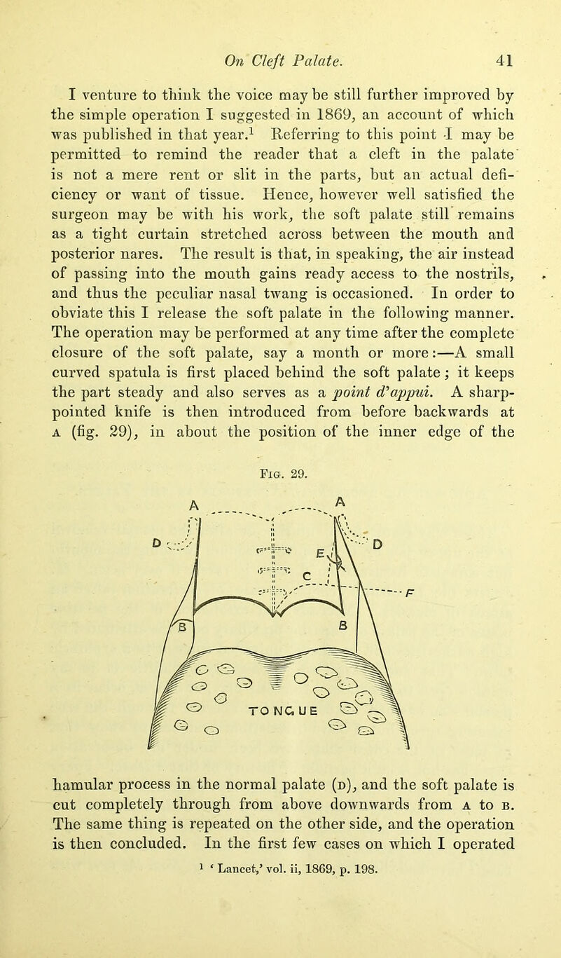 I venture to think the voice may be still further improved by the simple operation I suggested in 1869, an account of -which was published in that yeard Referring to this point I may be permitted to remind the reader that a cleft in the palate is not a mere rent or slit in the parts, but an actual defi- ciency or want of tissue. Hence, however well satisfied the surgeon may be with his work, the soft palate still remains as a tight curtain stretched across between the mouth and posterior nares. The result is that, in speaking, the air instead of passing into the mouth gains ready access to the nostrils, and thus the peculiar nasal twang is occasioned. In order to obviate this I release the soft palate in the following manner. The operation may be performed at any time after the complete closure of the soft palate, say a month or more:—A small curved spatula is first placed behind the soft palate; it keeps the part steady and also serves as a point d’appui. A sharp- pointed knife is then introduced from before backwards at A (fig. 29), in about the position of the inner edge of the Fig. 29. hamular process in the normal palate (n), and the soft palate is cut completely through from above downwards from a to b. The same thing is repeated on the other side, and the operation is then concluded. In the first few cases on which I operated ' ‘ Lancet,’ vol. ii, 1869, p. 198.