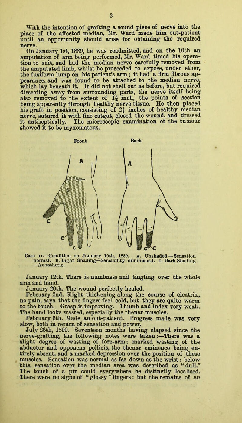 With the intention of grafting a sound piece of nerre into the place of the affected median, Mr. Ward made him out-patient until an opportunity should arise for obtaining the required nerve. On January 1st, 1889, he was readmitted, and on the 10th an amputation of arm being performed, Mr. Ward timed his opera- tion to suit, and had the median nerve carefully removed from the amputated limb, whilst he proceeded to expose, under ether, the fusiform lump on his patient’s arm; it had a firm fibrous ap- pearance, and was found to be attached to the median nerve, which lay beneath it. It did not shell out as before, but required dissecting away from surrounding parts, the nerve itself being also removed to the extent of If inch, the points of section being apparently through healthy nerve tissue. He then placed his graft in position, consisting of 2| inches of healthy median nerve, sutured it with fine catgut, closed the wound, and dressed it antiseptically. The microscopic examination of the tumour showed it to be myxomatous. Case II.—Condition on January 10th, 1889. A. Unshaded — Sensation normal. B. Light Shading—Sensibility diminished, c. Dark Shading —Ansesthetic. January 12th. There is numbness and tingling over the whole arm and hand. January 20th. The wound perfectly healed. February 2nd. Slight thickening along the course of cicatrix, no pain, says that the fingers feel cold, but they are quite warm to the touch. Grasp is improving. Thumb and index very weak. The hand looks wasted, especially the thenar muscles. February 6th. Made an out-patient. Progress made was very slow, both in return of sensation and power. July 26th, 1890. Seventeen months having elapsed since the nerve-grafting, the following notes were taken:—There was a slight degree of wasting of fore-arm; marked wasting of the abductor and opponens pollicis, the thenar eminence being en- tirely absent, and a marked depression over the position of these muscles. Sensation was normal as far down as the wrist; below this, sensation over the median area was described as “ dull.” The touch of a pin could everywhere be distinctly localised. There were no signs of “ glossy ” fingers: but the remains of an Front Back