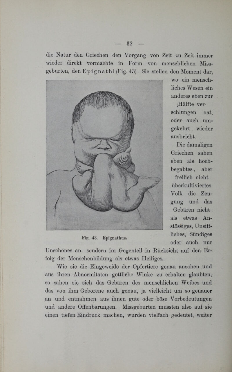 die Natur den Griechen den Vorgang von Zeit zu Zeit immer wieder direkt vormachte in Form von menschlichen Miss- geburten, den Epignathi (Fig. 43). Sie stellen den Moment dar, wo ein mensch- liches Wesen ein anderes eben zur [Hälfte ver- schlungen hat, oder auch um- gekehrt wieder ausbricht. Die damaligen Griechen sahen eben als hoch- begabtes , aber freilich nicht überkultiviertes Volk die Zeu- gung und das Gebären nicht als etwas An- stössiges, Unsitt- liches, Sündiges oder auch nur Unschönes an, sondern im Gegenteil in Rücksicht auf den Er- folg der Menschenbildung als etwas Heiliges. Wie sie die Eingeweide der Opfertiere genau an sahen und aus ihren Abnormitäten göttliche Winke zu erhalten glaubten, so sahen sie sich das Gebären des menschlichen Weibes und das von ihm Geborene auch genau, ja vielleicht um so genauer an und entnahmen aus ihnen gute oder böse Vorbedeutungen und andere Offenbarungen. Missgeburten mussten also auf sie einen tiefen Eindruck machen, wurden vielfach gedeutet, weiter Fig. 43. Epignathus.