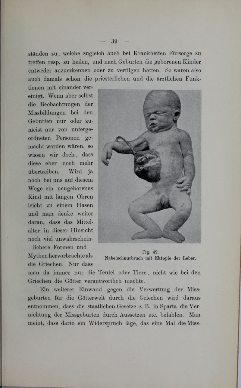 ständen zu, welche zugleich auch bei Krankheiten Fürsorge zu treffen resp. zu heilen, und nach Geburten die geborenen Kinder entweder anzuerkennen oder zu vertilgen hatten. So waren also auch damals schon die priesterlichen und die ärztlichen Funk- tionen mit einander ver- einigt. Wenn aber selbst die Beobachtungen der Missbildungen bei den Geburten nur oder zu- meist nur von unterge- ordneten Personen ge- macht worden wären, so wissen wir doch, dass diese eher noch mehr übertreiben. Wird ja noch bei uns auf diesem Wege ein neugeborenes Kind mit langen Ohren leicht zu einem Hasen und man denke weiter daran, dass das Mittel- alter in dieser Hinsicht noch viel unwahrschein- lichere Formen und Mythen hervorbrachte als die Griechen. Nur dass man da immer nur die Teufel oder Tiere, nicht wie bei den Griechen die Götter verantwortlich machte. Ein weiterer Ein wand gegen die Verwertung der Miss- geburten für die Götterwelt durch die Griechen wird daraus entnommen, dass die staatlichen Gesetze z. B. in Sparta die Ver- nichtung der Missgeburten durch Aussetzen etc. befahlen. Man meint, dass darin ein Widerspruch läge, das eine Mal die Miss- Fig. 49. Nabelschnurbruch mit Ektopie der Leber.