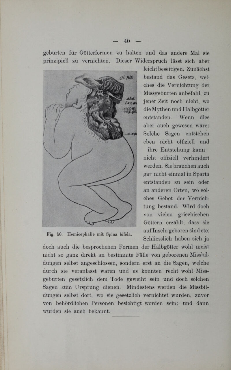 gebürten für Götterformen zu halten und das andere Mal sie prinzipiell zu vernichten. Dieser Widerspruch lässt sich aber leicht beseitigen. Zunächst bestand das Gesetz, wel- ches die Vernichtung der Missgeburten anbefahl, zu jener Zeit noch nicht, wo die Mythen und Halbgötter entstanden. Wenn dies aber auch gewesen wäre: Solche Sagen entstehen eben nicht offiziell und ihre Entstehung kann nicht offiziell verhindert werden. Sie brauchen auch gar nicht einmal in Sparta entstanden zu sein oder an anderen Orten, wo sol- ches Gebot der Vernich- tung bestand. Wird doch von vielen griechischen Göttern erzählt, dass sie auf Inseln geboren sind etc. Schliesslich haben sich ja doch auch die besprochenen Formen der Halbgötter wohl meist nicht so ganz direkt an bestimmte Fälle von geborenen Missbil- dungen selbst angeschlossen, sondern erst an die Sagen, welche durch sie veranlasst waren und es konnten recht wohl Miss- geburten gesetzlich dem Tode geweiht sein und doch solchen Sagen zum Ursprung dienen. Mindestens werden die Missbil- dungen selbst dort, wo sie gesetzlich vernichtet wurden, zuvor von behördlichen Personen besichtigt worden sein; und dann wurden sie auch bekannt.