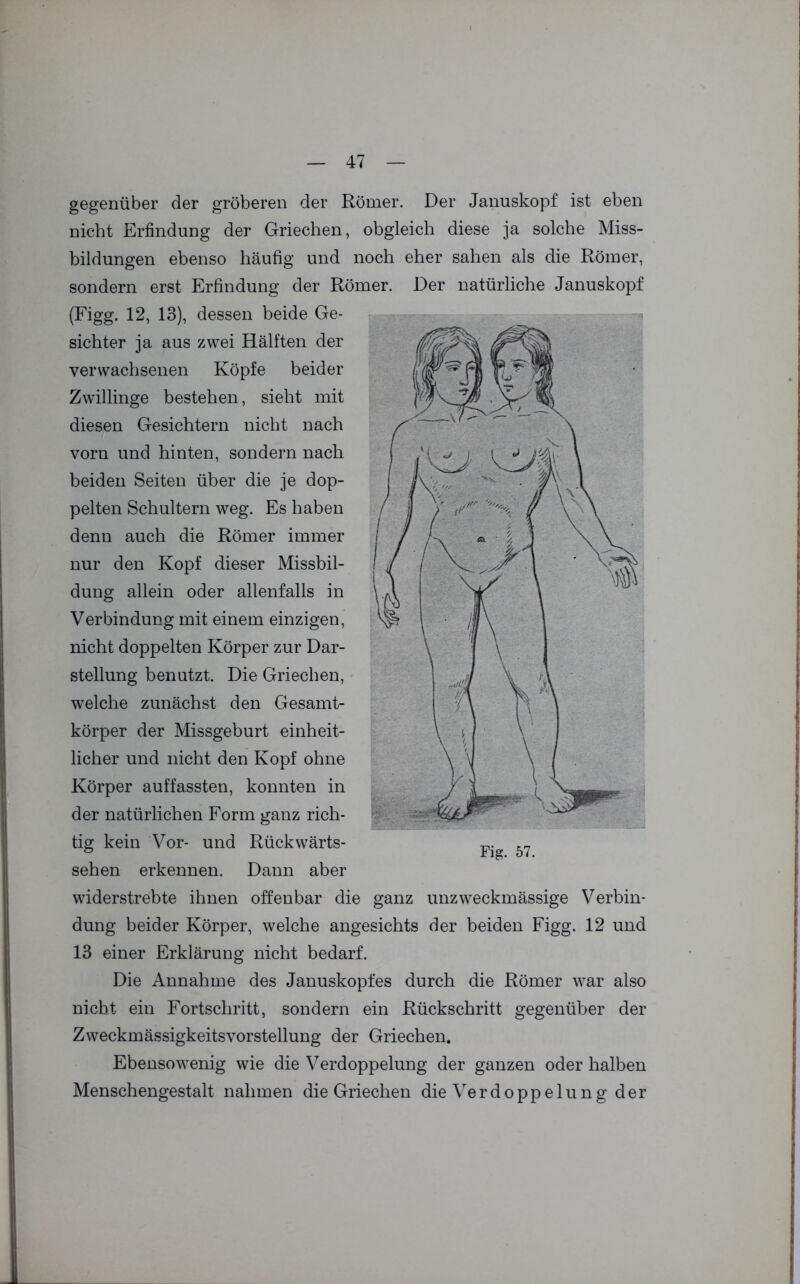 gegenüber der gröberen der Römer. Der Januskopf ist eben nicht Erfindung der Griechen, obgleich diese ja solche Miss- bildungen ebenso häufig und noch eher sahen als die Römer, sondern erst Erfindung der Römer. Der natürliche Januskopf (Figg. 12, 13), dessen beide Ge- sichter ja aus zwei Hälften der verwachsenen Köpfe beider Zwillinge bestehen, sieht mit diesen Gesichtern nicht nach vorn und hinten, sondern nach beiden Seiten über die je dop- pelten Schultern weg. Es haben denn auch die Römer immer nur den Kopf dieser Missbil- dung allein oder allenfalls in Verbindung mit einem einzigen, nicht doppelten Körper zur Dar- stellung benutzt. Die Griechen, welche zunächst den Gesamt- körper der Missgeburt einheit- licher und nicht den Kopf ohne Körper auffassten, konnten in der natürlichen Form ganz rich- tig kein Vor- und Rückwärts- sehen erkennen. Dann aber widerstrebte ihnen offenbar die ganz unzweckmässige Verbin- dung beider Körper, welche angesichts der beiden Figg. 12 und 13 einer Erklärung nicht bedarf. Die Annahme des Januskopfes durch die Römer war also nicht ein Fortschritt, sondern ein Rückschritt gegenüber der Zweckmässigkeitsvorstellung der Griechen. Ebensowenig wie die Verdoppelung der ganzen oder halben Menschengestalt nahmen die Griechen die Verdoppelung der