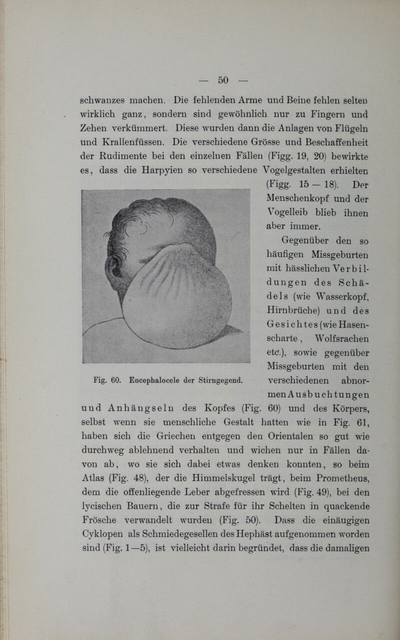 Schwanzes machen. Die fehlenden Arme und Beine fehlen selten wirklich ganz, sondern sind gewöhnlich nur zu Fingern und Zehen verkümmert. Diese wurden dann die Anlagen von Flügeln und Krallenfüssen. Die verschiedene Grösse und Beschaffenheit der Rudimente bei den einzelnen Fällen (Figg. 19, 20) bewirkte es, dass die Harpyien so verschiedene Vogelgestalten erhielten (Figg. 15 — 18). Der Menschenkopf und der Vogelleib blieb ihnen aber immer. Gegenüber den so häufigen Missgeburten mit hässlichen Ve r b i 1- dungen des Schä- dels (wie Wasserkopf, Hirnbrüche) und des Gesichtes (wieHasen- scharte , Wolfsrachen etc.), sowie gegenüber Missgeburten mit den verschiedenen abnor- men Ausbuch t ungen und Anhängseln des Kopfes (Fig. 60) und des Körpers, selbst wenn sie menschliche Gestalt hatten wie in Fig. 61, haben sich die Griechen entgegen den Orientalen so gut wie durchweg ablehnend verhalten und wichen nur in Fällen da- von ab, wo sie sich dabei etwas denken konnten, so beim Atlas (Fig. 48), der die Himmelskugel trägt, beim Prometheus, dem die offenliegende Leber abgefressen wird (Fig. 49), bei den lycischen Bauern, die zur Strafe für ihr Schelten in quackende Frösche verwandelt wurden (Fig. 50). Dass die einäugigen Cyklopen als Schmiedegesellen des Hephäst aufgenommen worden sind (Fig. 1—5), ist vielleicht darin begründet, dass die damaligen Fig. 60. Encephalocele der Stirngegend.