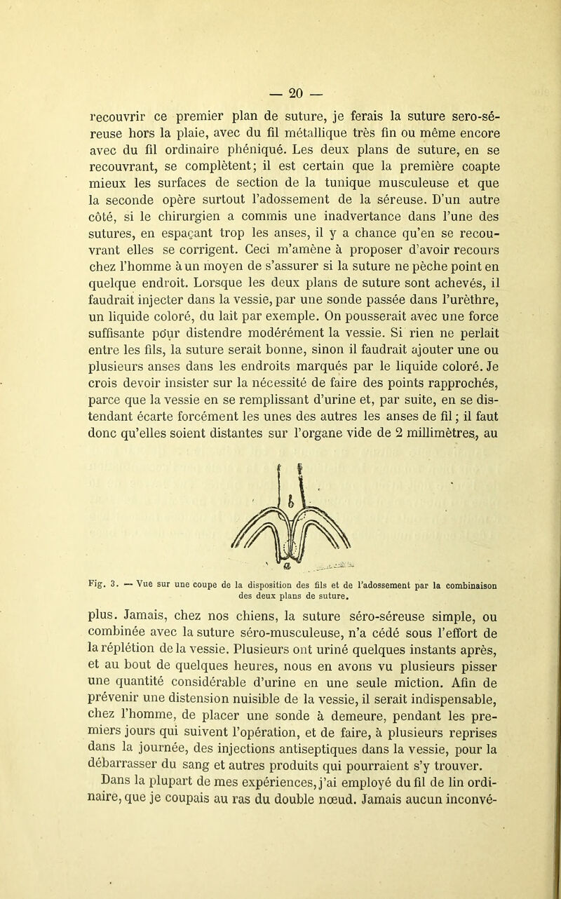 recouvrir ce premier plan de suture, je ferais la suture sero-sé- reuse hors la plaie, avec du fil métallique très fin ou même encore avec du fil ordinaire phéniqué. Les deux plans de suture, en se recouvrant, se complètent; il est certain que la première coapte mieux les surfaces de section de la tunique musculeuse et que la seconde opère surtout l’adossement de la séreuse. D’un autre côté, si le chirurgien a commis une inadvertance dans l’une des sutures, en espaçant trop les anses, il y a chance qu’en se recou- vrant elles se corrigent. Ceci m’amène à proposer d’avoir recours chez l’homme à un moyen de s’assurer si la suture ne pèche point en quelque endroit. Lorsque les deux plans de suture sont achevés, il faudrait injecter dans la vessie, par une sonde passée dans l’urèthre, un liquide coloré, du lait par exemple. On pousserait avec une force suffisante pdur distendre modérément la vessie. Si rien ne perlait entre les fils, la suture serait bonne, sinon il faudrait ajouter une ou plusieurs anses dans les endroits marqués par le liquide coloré. Je crois devoir insister sur la nécessité de faire des points rapprochés, parce que la vessie en se remplissant d’urine et, par suite, en se dis- tendant écarte forcément les unes des autres les anses de fil ; il faut donc qu’elles soient distantes sur l’organe vide de 2 millimètres., au Fig. 3. — Vue sur une coupe de la disposition des fils et de l’adossement par la combinaison des deux plans de suture. plus. Jamais, chez nos chiens, la suture séro-séreuse simple, ou combinée avec la suture séro-musculeuse, n’a cédé sous l’effort de laréplétion delà vessie. Plusieurs ont uriné quelques instants après, et au bout de quelques heures, nous en avons vu plusieurs pisser une quantité considérable d’urine en une seule miction. Afin de prévenir une distension nuisible de la vessie, il serait indispensable, chez l’homme, de placer une sonde à demeure, pendant les pre- miers jours qui suivent l’opération, et de faire, à plusieurs reprises dans la journée, des injections antiseptiques dans la vessie, pour la débarrasser du sang et autres produits qui pourraient s’y trouver. Dans la plupart de mes expériences, j’ai employé du fil de lin ordi- naire, que je coupais au ras du double nœud. Jamais aucun inconvé-