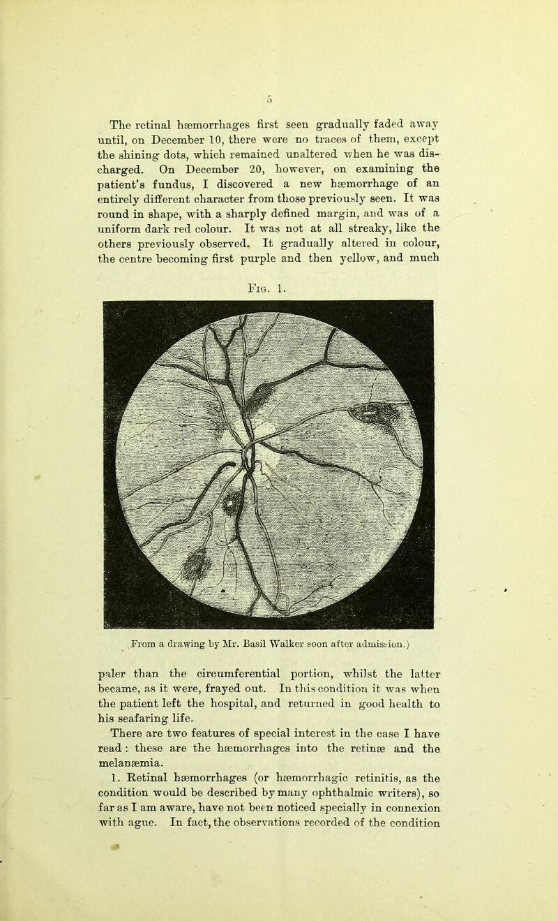 .From a drawing by Mr. Basil Walker soon after admission,) paler than the circumferential portion, whilst the lalter became, as it were, frayed out. In this condition it was when the patient left the hospital, and returned in good health to his seafaring life. There are two features of special interest in the case I have read : these are the haemorrhages into the retinre and the melansemia. 1. Retinal haemorrhages (or haemorrhagic retinitis, as the condition would be described by many ophthalmic writers), so far as I am aware, have not been noticed specially in connexion with ague. In fact, the observations recorded of the condition The retinal haemorrhages first seen gradually faded away until, on December 10, there were no traces of them, except the shining dots, which remained unaltered when he was dis- charged. On December 20, however, on examining the patient’s fundus, I discovered a new htemorrhage of an entirely different character from those previously seen. It was round in shape, with a sharply defined margin, and was of a uniform dark red colour. It was not at all streaky, like the others previously observed. It gradually altered in colour, the centi’e becoming first purple and then yellow, and much Fig. 1.