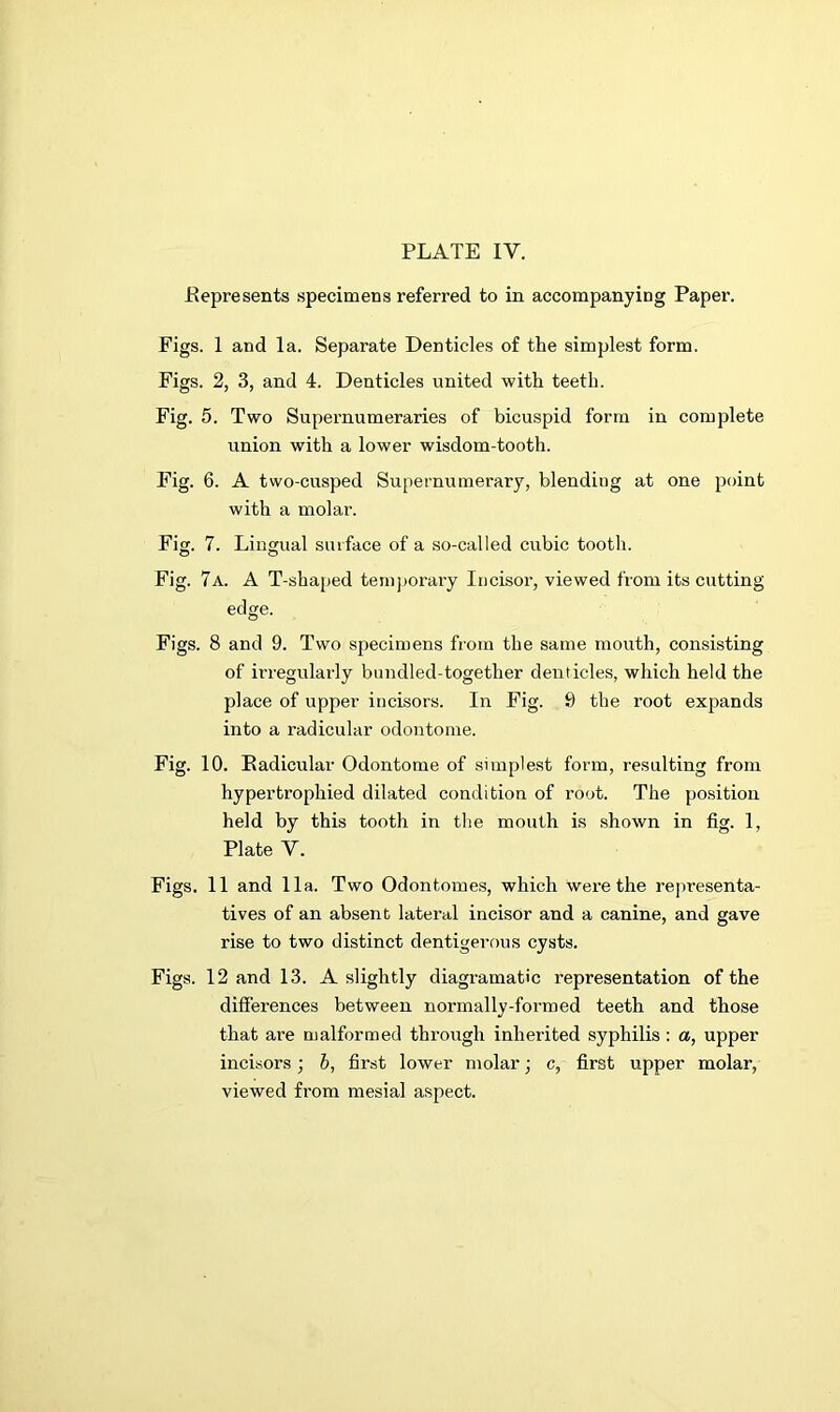 Represents specimens referred to in accompanying Paper. Figs. 1 and la. Separate Denticles of the simplest form. Figs. 2, 3, and 4. Denticles united with teeth. Fig. 5. Two Supernumeraries of bicuspid form in complete union with a lower wisdom-tooth. Fig. 6. A two-cusped Supernumerary, blending at one point with a molar. Fig. 7. Lingual surface of a so-called cubic tooth. Fig. 7a. A T-shaped temporary Incisor, viewed from its cutting edge. Figs. 8 and 9. Two specimens from the same mouth, consisting of irregularly bundled-together denticles, which held the place of upper incisors. In Fig. 9 the root expands into a radicular odontome. Fig. 10. Radicular Odontome of simplest form, resulting from hypertrophied dilated condition of root. The position held by this tooth in the mouth is shown in fig. 1, Plate Y. Figs. 11 and 11a. Two Odontomes, which were the representa- tives of an absent lateral incisor and a canine, and gave rise to two distinct dentigerous cysts. Figs. 12 and 13. A slightly diagramatic representation of the differences between normally-formed teeth and those that are malformed through inherited syphilis : a, upper incisors; b, first lower molar; c, first upper molar, viewed from mesial aspect.