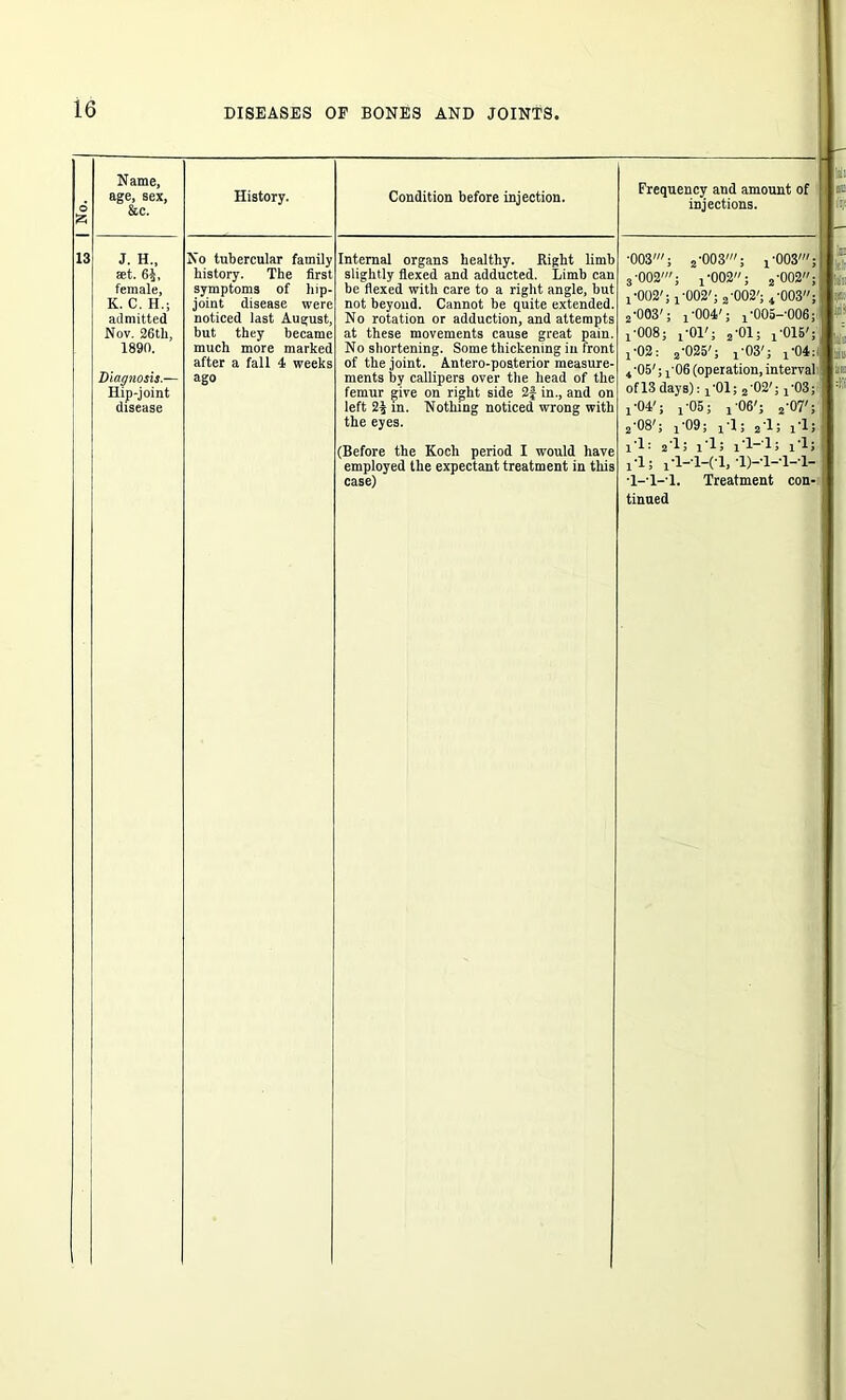 o £ Name, age, sex, &c. History. Condition before injection. 13 J. H„ ffit. 6J, female, K. C. H.; admitted Nov. 26th, 1890. Diagnosis.— Hip-joint disease No tubercular family history. The first symptoms of liip- joint disease were noticed last August, but they became much more marked after a fall 4 weeks ago Internal organs healthy. Right limb slightly flexed and adducted. Limb can be flexed with care to a right angle, but not beyond. Cannot be quite extended. No rotation or adduction, and attempts at these movements cause great pain. No shortening. Some thickening in front of the joint. Antero-posterior measure- ments by callipers over the head of the femur give on right side 2f in., and on left 24 in. Nothing noticed wrong with the eyes. (Before the Kocli period I would have employed the expectant treatment in this case) Frequency and amount of injections. •003'; j-003'; j'003'; 3'002'; ! *002; 2'002; 1'002'; 1-002'; 2-002';4-003; 2-003'; i'004'; x'005-006; i’008; i ’01'; 2-01; i'015'; ! *02 : 2*025'; j *03'; i‘04:l 4*05'; j-06 (operation, interval of 13days): i'01; 2*02'; 1-03; j-04'; j-05; ! 06'; 2*07'; 2*08'; j‘09; ! 1; 2T; i‘l; !-l: 2*1; 1*1; 1*1-1; x 1; 1-1; i-l-l-Cl, D-'l- l-T- 1-1-1. Treatment con- tinued