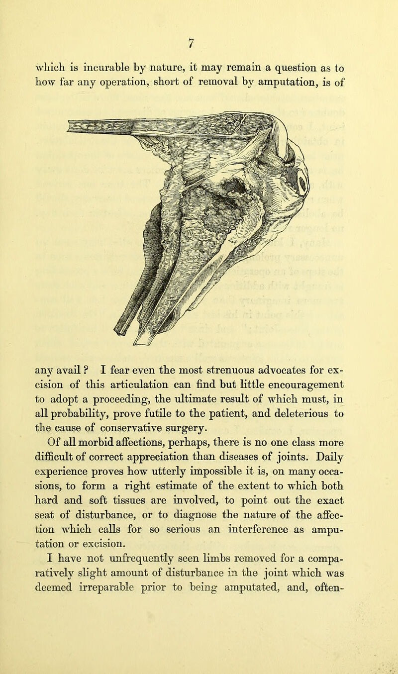 wKicli is incurable by nature, it may remain a question as to how far any operation, short of removal by amputation, is of any avail ? I fear even the most strenuous advocates for ex- cision of this articulation can find but little encouragement to adopt a proceeding, the ultimate result of which must, in all probability, prove futile to the patient, and deleterious to the cause of conservative surgery. Of all morbid afiections, perhaps, there is no one class more difficult of correct appreciation than diseases of joints. Daily experience proves how utterly impossible it is, on many occa- sions, to form a right estimate of the extent to which both hard and soft tissues are involved, to point out the exact seat of disturbance, or to diagnose the nature of the affec- tion which calls for so serious an interference as ampu- tation or excision. I have not unfrequently seen limbs removed for a compa- ratively sKght amount of disturbance in the joint which was deemed irreparable prior to being amputated, and, often-