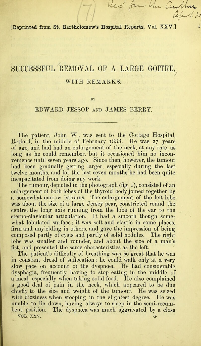 vLi^c [Reprinted from St. Bartholomew’s Hospital Reports, Vol. XXV.] SUCCESSFUL REMOVAL OF A LARGE GOITRE, V WITH REMARKS. BY EDWARD JESSOP and JAMES BERRY. Tlie patient, Jolm W., was sent to the Cottage Hospital, Eetford, in the middle of February 1888. He was 27 years of age, and had had an enlargement of the neck, at any rate, as long as he could remember, but it occasioned him no incon- venience until seven years ago. Since then, however, the tumour had been gradually getting larger, especially during the last twelve months, and for the last seven months he had been quite incapacitated from doing any work. The tumour, depicted in the photograph (fig. i), consisted of an enlargement of both lobes of the thyroid body joined together by a somewhat narrow isthmus. The enlargement of the left lobe was about the size of a large Jersey pear, constricted round the centre, the long axis running from the lobe of the ear to the sterno-clavicular articulation. It had a smooth though some- what lobulated surface; it was soft and elastic in some places, firm and unyielding in others, and gave the impression of being composed partly of cysts and partly of solid nodules. The right lobe was smaller and rounder, and about the size of a man’s fist, and presented the same characteristics as the left. The patient’s difficulty of breathing was so great that he was in constant dread of suffocation; he could walk only at a very slow pace on account of the dyspnoea. He had considerable dysphagia, frequently having to stop eating in the middle of a meal, especially when taking solid food. He also complained a good deal of pain in the neck, which appeared to be due chiefly to the size and weight of the tumour. He was seized with dizziness when stooping in the slightest degree. He was unable to lie down, having always to sleep in the semi-recum- bent position. The dyspnoea was much aggravated by a close VOL. XXV. G
