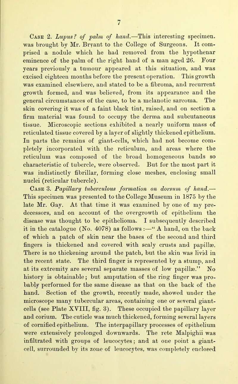 Case 2. Lupus? of palm of hand.—This interesting specimen, was brought by Mr. Bryant to the College of Surgeons. It com- prised a nodule which he had removed from the hypothenar eminence of the palm of the right hand of a man aged 26. Four years previously a tumour appeared at this situation, and was excised eighteen months before the present operation. This growth was examined elsewhere, and stated to be a fibroma, and recurrent growth formed, and was believed, from its appearance and the general circumstances of the case, to be a melanotic sarcoma. The skin covering it was of a faint black tint, raised, and on section a firm material was found to occupy the derma and subcutaneous tissue. Microscopic sections exhibited a nearly uniform mass of reticulated tissue covered by a layer of slightly thickened epithelium. In parts the remains of giant-cells, which had not become com- pletely incorporated with the reticulum, and areas where the reticulum was composed of the broad homogeneous bands so characteristic of tubercle, were observed. But for the most part it was indistinctly fibrillar, forming close meshes, enclosing small nuclei (reticular tubercle). Case 3. Papillary tuberculous formation on dorsum of hand.— This specimen was presented to the College Museum in 1875 by the late Mr. Gray. At that time it was examined by one of my pre- decessors, and on account of the overgrowth of epithelium the disease was thought to be epithelioma. I subsequently described it in the catalogue (No. 4078) as follows :—“ A hand, on the back of which a patch of skin near the bases of the second and third fingers is thickened and covered with scaly crusts and papillae. There is no thickening around the patch, but the skin was livid in the recent state. The third finger is represented by a stump, and at its extremity are several separate masses of low papillae.” No history is obtainable; but amputation of the ring finger was pro- bably performed for the same disease as that on the back of the hand. Section of the growth, recently made, showed under the microscope many tubercular areas, containing one or several giant- cells (see Plate XVIII, fig. 3). These occupied the papillary layer and corium. The cuticle was much thickened, forming several layers of cornified epithelium. The interpapillary processes of epithelium were extensively prolonged downwards. The rete Malpigliii was infiltrated with groups of leucocytes; and at oue point a giant- cell, surrounded by its zone of leucocytes, was completely enclosed