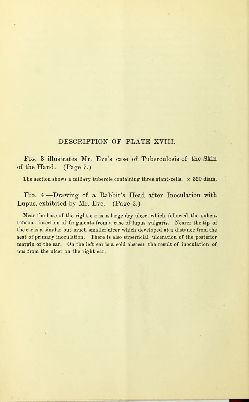 DESCRIPTION OF PLATE XVIII. Fig. 3 illustrates Mr. Eve’s case of Tuberculosis of the Skin of tbe Hand. (Page 7.) The section shows a miliary tubercle containing three giant-cells, x 320 diam. Fig. 4.—Drawing of a Rabbit’s Head after Inoculation with Lupus, exhibited by Mr. Eve. (Page 3.) Near the base of the right ear is a large dry ulcer, which followed the subcu- taneous insertion of fragments from a case of lupus vulgaris. Nearer the tip of the ear is a similar but much smaller ulcer which developed at a distance from the seat of primary inoculation. There is also superficial ulceration of the posterior margin of the ear. On the left ear is a cold abscess the result of inoculation of pus from the ulcer on the right ear.