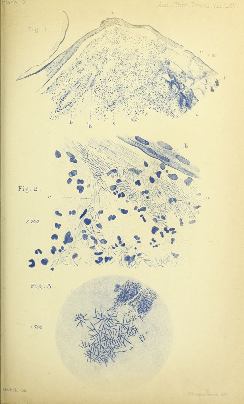■late 1/. i'/isa. _ Fig. 2 4 *’ n ' 'x,\ ~$ ; §§*. -a- w / ' ''%*£’ Jt' 9B •' \V\'- c - . jm ■ - ■.’•« X 7C0 jSgffi * £ M fit % f.•-•:/- ) «#! idtau <s#w v V * | „» • .% f KN\ Fig . 3 X 700 Hollick d«