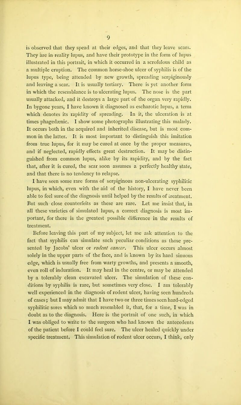 is observed that they spead at their edges, and that they leave scars. They are in reality lupus, and have their prototype in the form of lupus illustrated in this portrait, in which it occurred in a scrofulous child as a multiple eruption. The common horse-shoe ulcer of syphilis is of the lupus type, being attended by new growth, spreading serpiginously and leaving a scar. It is usually tertiary. There is yet another form in which the resemblance is to ulcerating lupus. The nose is the part usually attacked, and it destroys a large part of the organ very rapidly. In bygone years, I have known it diagnosed as escharotic lupus, a term which denotes its rapidity of spreading. In it, the ulceration is at times phagedtenic. I show some photographs illustrating this malady. It occurs both in the acquired and inherited disease, but is most com- mon in the latter. It is most important to distinguish this imitation from true lupus, for it may be cured at once by the proper measures, and if neglected, rapidly effects great destruction. It may be distin- guished from common lupus, alike by its rapidity, and by the fact that, after it is cured, the scar soon assumes a perfectly healthy state, and that there is no tendency to relapse. I have seen some rare forms of serpiginous non-ulcerating syphilitic lupus, in which, even with the aid of the history, I have never been able to feel sure of the diagnosis until helped by the results of treatment. But such close counterfeits as these are rare. Let me insist that, in all these varieties of simulated lupus, a correct diagnosis is most im- portant, for there is the greatest possible difference in the results of treatment. Before leaving this part of my subject, let me ask attention to the fact that syphilis can simulate such peculiar conditions as those pre- sented by Jacobs’ ulcer or rodent cancer. This ulcer occurs almost solely in the upper parts of the face, and is known by its hard sinuous edge, which is usually free from warty growths, and presents a smooth, even roll of induration. It may heal in the centre, or may be attended by a tolerably clean excavated ulcer. The simulation of these con- ditions by syphilis is rare, but sometimes very close. I am tolerably well experienced in the diagnosis of rodent ulcer, having seen hundreds of cases; but I may admit that I have two or three times seen hard-edged syphilitic sores which so much resembled it, that, for a time, I was in doubt as to the diagnosis. Here is the portrait of one such, in w'hich I was obliged to write to the surgeon who had known the antecedents of the patient before I could feel sure. The ulcer healed quickly under specific treatment. This simulation of rodent ulcer occurs, I think, only