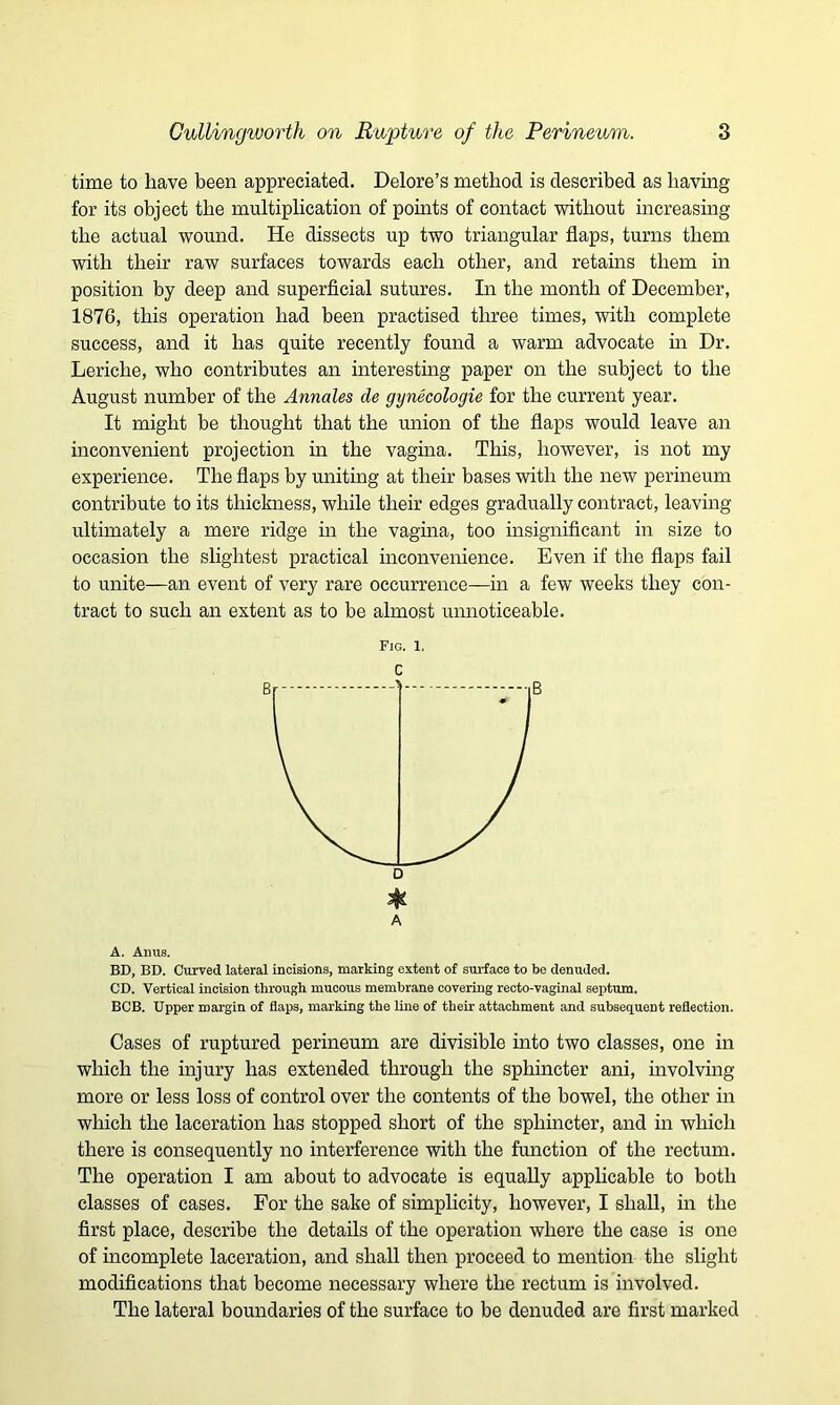 time to have been appreciated. Delore’s method is described as having for its object the multiplication of points of contact without increasing the actual wound. He dissects up two triangular flaps, turns them with their raw surfaces towards each other, and retains them in position by deep and superficial sutures. In the month of December, 1876, this operation had been practised three times, with complete success, and it has quite recently found a warm advocate in Dr. Leriche, who contributes an interesting paper on the subject to the August number of the Annales cle gynecologie for the current year. It might be thought that the union of the flaps would leave an inconvenient projection in the vagina. This, however, is not my experience. The flaps by uniting at their bases with the new perineum contribute to its thickness, while their edges gradually contract, leaving ultimately a mere ridge in the vagina, too insignificant in size to occasion the slightest practical inconvenience. Even if the flaps fail to unite—an event of very rare occurrence—in a few weeks they con- tract to such an extent as to be almost unnoticeable. Fig. 1. c 3^ A A. Alius. BD, BD. Curved lateral incisions, marking extent of surface to be denuded. CD. Vertical incision through mucous membrane covering recto-vaginal septum. BCB. Upper margin of flaps, marking the line of their attachment and subsequent reflection. Cases of ruptured perineum are divisible into two classes, one in which the injury has extended through the sphincter ani, involving- more or less loss of control over the contents of the bowel, the other in which the laceration has stopped short of the sphincter, and in which there is consequently no interference with the function of the rectum. The operation I am about to advocate is equally applicable to both classes of cases. For the sake of simplicity, however, I shall, in the first place, describe the details of the operation where the case is one of incomplete laceration, and shall then proceed to mention the slight modifications that become necessary where the rectum is involved. The lateral boundaries of the surface to be denuded are first marked