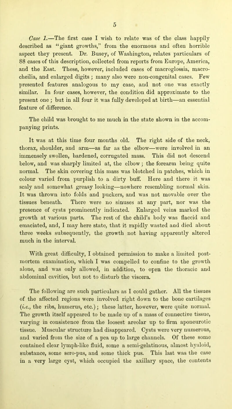 Case 1.—The first case I wish to relate was of the class happily described as “giant growths,” from the enormous and often horrible aspect they present. Dr. Busey, of Washington, relates particulars of 88 cases of this description, collected from reports from Europe, America, and the East. These, however-, included cases of macroglossia, macro- cheilia, and enlarged digits ; many also were non-congenital cases. Few presented features analogous to my case, and not one was exactly similar. In four cases, however, the condition did approximate to the present one ; but in all four it was fully developed at birth—an essential feature of difference. The child was brought to me much in the state shown in the accom- panying prints. It was at this time four months old. The right side of the neck, thorax, shoulder, and arm—as far as the elbow—were involved in an immensely swollen, hardened, corrugated mass. This did not descend below, and was sharply limited at, the elbow; the forearm being quite normal. The skin covering this mass was blotched in patches, which in colour varied from purplish to a dirty buff. Here and there it was scaly and somewhat greasy looking—nowhere resembling normal skin. It was thrown into folds and puckers, and was not movable over the tissues beneath. There were no sinuses at any part, nor was the presence of cysts prominently indicated. Enlarged veins marked the growth at various parts. The rest of the child’s body was flaccid and emaciated, and, I may here state, that it rapidly wasted and died about three weeks subsequently, the growth not having apparently altered much in the interval. With great difficulty, I obtained permission to make a limited post- mortem examination, which I was compelled to confine to the growth alone, and was only allowed, in addition, to open the thoracic and abdominal cavities, but not to disturb the viscera. The following are such particulars as I could gather. All the tissues of the affected regions were involved right down to the bone cartilages (i.e., the ribs, humerus, etc.); these latter, however, were quite normal. The growth itself appeared to be made up of a mass of connective tissue, varying in consistence from the loosest areolar up to firm aponeurotic tissue. Muscular structure had disappeared. Cysts were very numerous, and varied from the size of a pea up to large channels. Of these some contained clear lymph-like fluid, some a semi-gelatinous, almost hyaloid, substance, some sero-pus, and some thick pus. This last was the case in a very large cyst, which occupied the axillary space, the contents