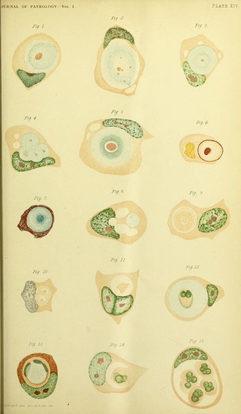 )URNAI. OF PATHOLOGY.—Voi. 1 Fig 2 Fig 13 rfi'cAiiAc*' anu f Fig 14 fm / i ■,-/ Fig 15 tC.RufTtr. in <$ &