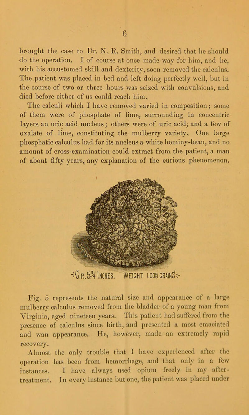 brought the case to Dr. N. R. Smith, and desired that he should do the operation. I of course at once made way for liim, and lie, with his accustomed skill and dexterity, soon removed the calculus. The patient was placed in bed and left doing perfectly well, but in the course of two or three hours was seized with convulsions, and died before either of us could reach him. The calculi which I have removed varied in composition; some of them were of phosphate of lime, surrounding in concentric layers an uric acid nucleus; others were of uric acid; and a few of oxalate of lime, constituting the mulberry variety. One large phosphatic calculus had for its nucleus a white hominy-bean, and no amount of cross-examination could extract from the patient, a man of about fifty years, any explanation of the curious phenomenon. Fig. 5 represents the natural size and appearance of a large mulberry calculus removed from the bladder of a young man from Virginia, aged nineteen years. This patient had suffered from the presence of calculus since birth, and presented a most emaciated and wan appearance. He, however, made an extremely rapid recovery. Almost the only trouble that I have experienced after the operation has been from hemorrhage, and that only in a few instances. I have always used opium freely in my after- treatment. In every instance but one, the patient was placed under