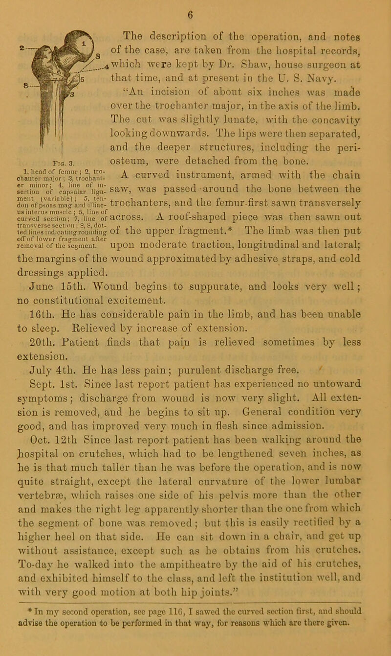 2 — 8 Fig. 3. 1, head of femur j 2, tro The description of the opei’ation, and notes ^ of the case, are taken from the hospital records, 4which were kept by Dr. Shaw, house surgeon at that time, and at present in the U. S, Navy. “An incision of about six inches was made over the troclianter major, in the axis of the limb. The cut was slightly lunate, with the concavity looking downwards. The lips were then separated, and the deeper structures, including the peri- osteum, were detached from thq bone, chanter major; 3, irochani- ^ cuiwed instrument, armed with the chain seriu!u°oi oap5u?ar°Ugnl saw, was passed • ai’ound the bone between the d!nofp,™aTmLgHiK^^^^ ti’ochantevs, and the femur-first sawn transversely us interns muscle; 5, line of a i- i i • j. curved secthm; 7, line ofacross. A root-shaped piece was then sawn out ted lines indicating rounding ot the Upper tragmeiit.* 1 he limb was then put off of lower fragment after , •.-i-i -iix i removal of the segment, upou moderate ti'actiou, loiigitudinal and lateral; the margins of the wound approximated by adhesive straps, and cold dressings applied. June 15th. Wound begins to suppurate, and looks very well; no constitutional excitement. 16th. He has considerable pain in the limb, and has been unable to sleep. Believed by increase of extension. 20th. Patient finds that pain is relieved sometimes by less extension, July 4th. He has less pain ; purulent discharge free. '' Sept. 1st. Since last report patient has experienced no untoward symptoms; discharge from wound is now very slight. All exten- sion is removed, and he begins to sit up. General condition very good, and has improved very much in flesh since admission. Oct. 12th Since last report patient has been v’alking around the hospital on crutches, which had to be lengthened seven inches, as he is that much taller than he was before the operation, and is now quite straight, except the lateral curvature of the lower lumbar vertebras, which raises one side of his pelvis more than the other and makes the right leg apparently shorter than the one from which the segment of bone was removed ; but this is easily rectified by a higher heel on that side. Ho can sit down in a chair, and get up without assistance, except such as he obtains from his crutches. To-day he walked into the ampitheatro by the aid of his crutches, and exhibited himself to the class, and left the institution well, and with very good motion at both hip joints.” * In my second operntion, see p.3ge IIC, I sawed the curved section first, and should advise the operation to be performed in that way, for reasons which are there given.