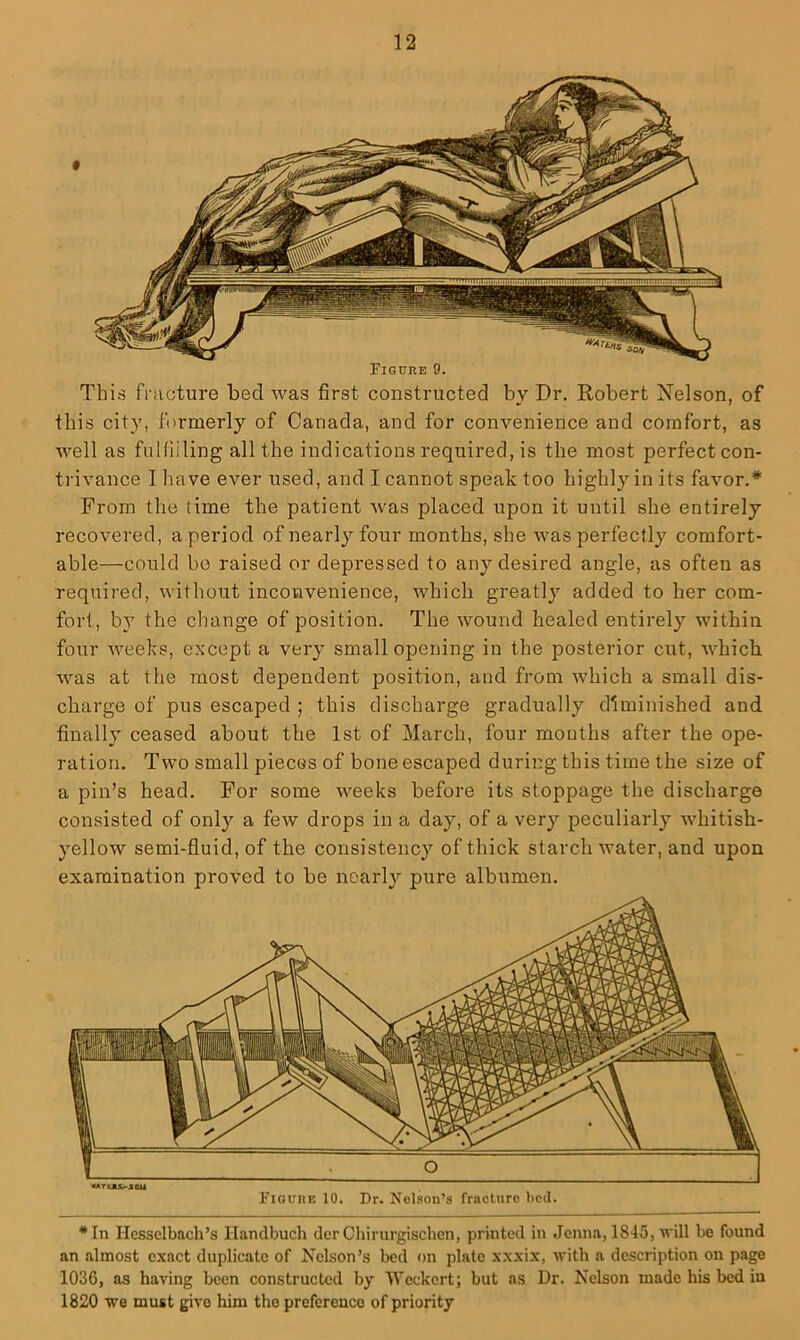 «ATi:«LS/.xau Figuiie 10. Dr. Nelson’s fracture lied. *In Hessclbach’s llandbuch dcr Cliirurgischen, printed in Jenna, 1845) will be found an almost exact duplicate of Nelson’s bed on plate xxxix, with a description on page 1036, as having been constructed by Weckert; but as Dr. Nelson made his bed in 1820 we must give him the preference of priority Figure 9. This fracture bed was first constructed by Dr. Robert Nelson, of this city, formerly of Canada, and for convenience and comfort, as well as fuHiiling all the indications required, is the most perfect con- ti'ivance 1 have ever used, and I cannot speak too highly in its favor.* From the time the patient was placed upon it until she entirely recovered, a period of nearly four months, she was perfectly comfort- able—could bo raised or depressed to any desired angle, as often as required, without inconvenience, which greatly added to her com- fort, b}’^ the change of position. The wound healed entirely within four weeks, except a very small opening in the posterior cut, which was at the most dependent position, and from which a small dis- charge of pus escaped ; this discharge gradually diminished and finally ceased about the 1st of March, four mouths after the ope- ration. Two small pieces of bone escaped during this time the size of a pin’s head. For some weeks before its stoppage the discharge consisted of only a few drops in a day, of a very peculiarly whitish- yellow semi-fluid, of the consistency of thick starch water, and upon examination proved to be nearl^i pure albumen.