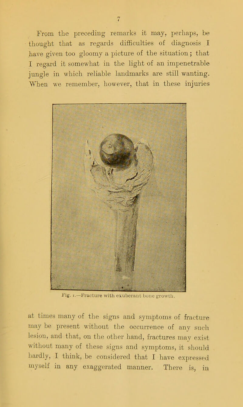 From the preceding remarks it may, perhaps, be thought that as regards difficulties of diagnosis I have given too gloomy a picture of the situation; that I regard it somewhat in the light of an impenetrable jungle in which reliable landmarks are still wanting. When we remember, however, that in these injuries •fig. 1.—Fracture with exuberant buiie growth. at times many of the signs and symptoms of fracture may be present without the occurrence of any such lesion, and that, on the other hand, fractures may exist without many of these signs and symptoms, it should hardly, I think, be considered that I have expressed myself in any exaggerated manner. There is, in