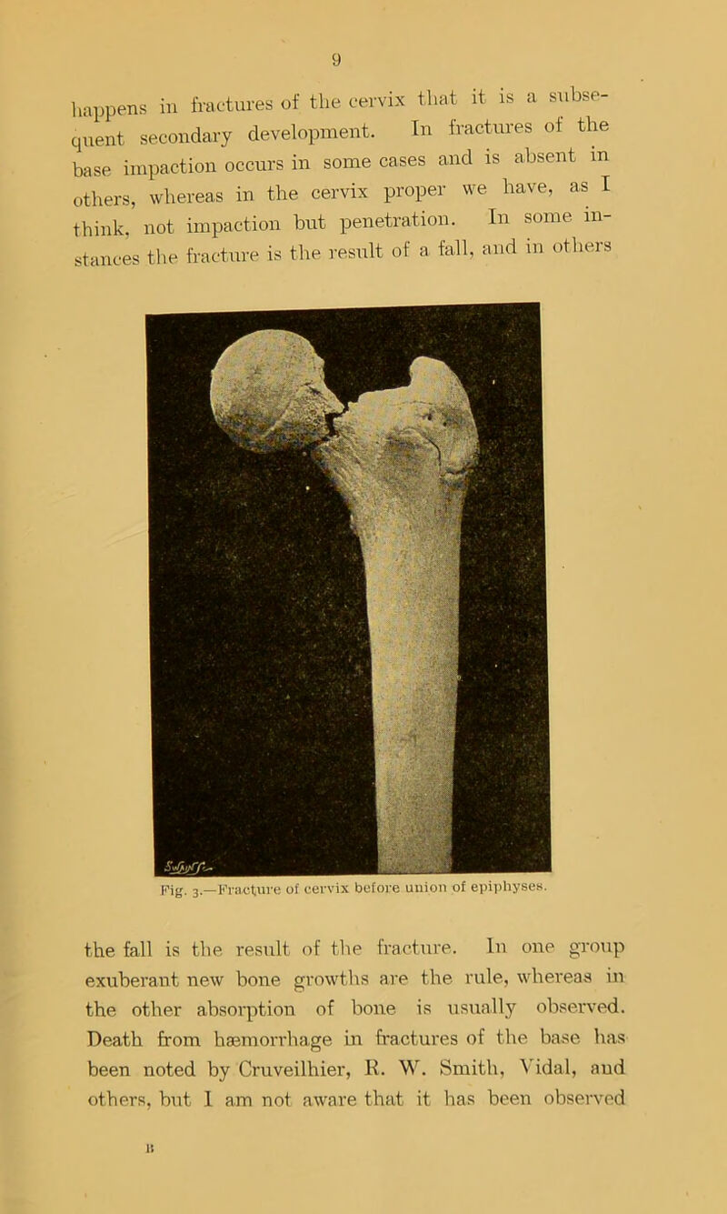 happens in fractures of the cervix that it is a subse- quent secondary development. In fractures of the base impaction occurs in some cases and is absent in others, whereas in the cervix proper we have, as I think, not impaction but penetration. In some in- stances the fracture is the result of a fall, and in others (i’ig. 3—Fracture of cervix before union of epiphyses. the fall is the result of the fracture. In one group exuberant new bone growths are the rule, whereas in the other absorption of bone is usually observed. Death from haemorrhage ui fractures of the base has been noted by Cruveilhier, K. W. Smith, Vidal, aud others, but I am not aware that it has been observed II