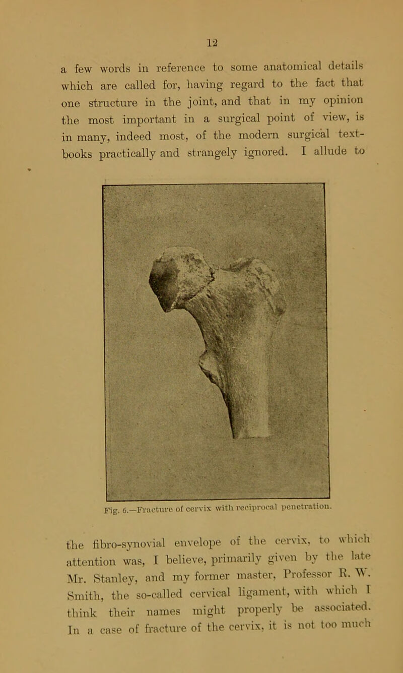 which are called for, having regard to the fact that one structure in the joint, and that in ray opinion the most important in a surgical point of view, is in many, indeed most, of the modern surgical text- books practically and strangely ignored. I allude to r- • . • '• . Fig. 6.—Fnictuve of cervix with reciprocal penetration. the fibro-synovial envelope of the cervix, to which attention was, I believe, primarily given by the Itde Mr. Stanley, and my former master. Professor R. M. Smith, the so-called cervical ligament, with which I think their names might properly be associated. In a case of fracture of the cervix, it is not too much