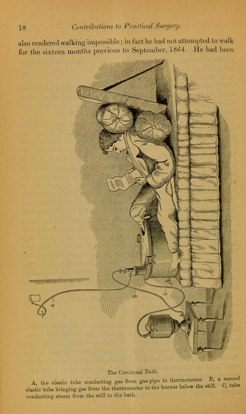 cilso rendered iinpos8il)le \ in fiict lie Imd not uttenipted to ivtillc for tlie sixteen months previous to Septcinbei, 1864. He had been The Continual Bath. A. the elastic tube conducting gas from gas-pipe to thermometer. B a second elastic tube bringing gas from the thermometer to the burner below the still. , u conducting steam from the still to the bath.