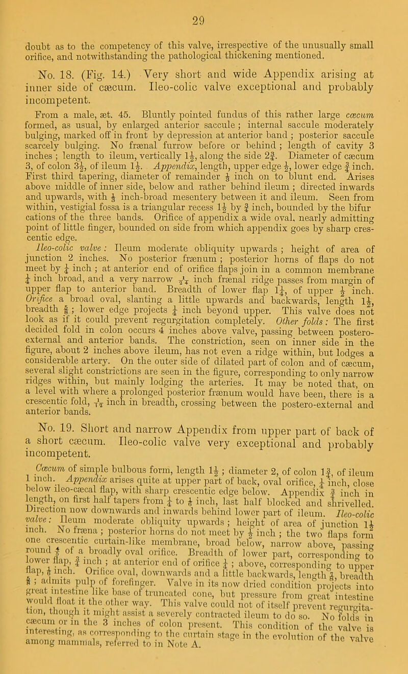 doubt as to the competency of this valve, irrespective of the unusually small orifice, and notwithstanding the pathological thickening mentioned. No. 18. (Fig. 14.) Very short and wide Appendix arising at inner side of caecum. Ileo-colic valve exceptional and probably incompetent. From a male, set. 45. Bluntly pointed fundus of this rather large ccecum formed, as usual, by enlarged anterior saccule ; internal saccule moderately bulging, marked off in front by depression at anterior band ; posterior saccule scarcely bulging. No freenal furrow before or behind ; length of cavity 3 inches ; length to ileum, vertically lb, along the side 2J. Diameter of csecum 3, of colon 3b, of ileum 1^. Appendix, length, upper edge b, lower edge f inch. First third tapering, diameter of remainder J inch on to blunt end. Arises above middle of inner side, below and rather behind ileum ; directed inwards and upwards, with J inch-broad mesentery between it and ileum. Seen from within, vestigial fossa is a triangular recess 11 by f inch, bounded by the bifur cations of the three bands. Orifice of appendix a wide oval, nearly admitting point of little finger, bounded on side from which appendix goes by sharp cres- centic edge. Ileo-colic valve : Ileum moderate obliquity upwards ; height of area of junction 2 inches. No posterior frsenum ; posterior horns of flaps do not meet by j- inch ; at anterior end of orifice flaps join in a common membrane ;j- inch broad, and a very narrow inch frjenal ridge passes from margin of upper flap to anterior band. Breadth of lower flap of upper b inch. Orifice a broad oval, slanting a little upwards and backwards, length lb, breadth f ; lower edge projects | inch beyond upper. This valve does not look as if it could prevent regurgitation completely. Other folds: The first decided fold in colon occurs 4 inches above valve, passing between postero- external and anterior bands. The constriction, seen on inner side in the figure, about 2 inches above ileum, has not even a ridge within, but lodges a considerable artery. On the outer side of dilated part of colon and of caecum, several slight constrictions are seen in the figure, corresponding to only narrow ridges within, but mainly lodging the arteries. It may be noted that, on a level with where a prolonged posterior fraenum would have been, there is a crescentic fold, T\ inch in breadth, crossing between the postero-external and anterior bands. No. 19. Short and narrow Appendix from upper part of back of a short csecum. Ileo-colic valve very exceptional and probably incompetent. J Omcim of simple bulbous form, length lb ; diameter 2, of colon If, of ileum 1 inch. Appendix arises quite at upper part of back, oval orifice, 1 inch, close below ifeo-csecal flap, with sharp crescentic edge below. Appendix f inch in length, on first half tapers from j- to £ inch, last half blocked and shrivelled. Direction now downwards and inwards behind lower part of ileum. Ileo-colic vaive: Ileum moderate obliquity upwards; height of area of junction U inch. JNo frsena ; posterior horns do not meet by b inch ; the two flaps form one crescentic curtain-like membrane, broad below, narrow above, passing roundJ of a broadly oval orifice. Breadth of lower part, corresponding to lower flap, f inch; at anterior end of orifice I ; above, corresponding to upper flap, i inch. Orifice oval, downwards and a little backwards, length g, breadth J ’ 1forefinger. Valve in its now dried condition projects into g eat intestme like base of truncated cone, but pressure from great intestine wouhl float it the other way. This valve could not of itself prevent regurgita- tion, though it might assist a severely contracted ileum to do so. No fokPs in fStSw” m the 3 mchtiS of col,on Present- This condition of the valve is interesting, as corresponding to the curtain stage in the evolution of the valve among mammals, referred to in Note A e