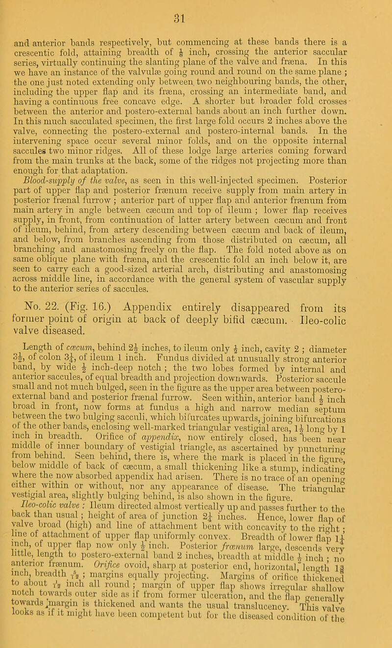 and anterior bands respectively, but commencing at these bands there is a crescentic fold, attaining breadth of & inch, crossing the anterior saccular series, virtually continuing the slanting plane of the valve and fraena. In this we have an instance of the valvulse going round and round on the same plane ; the one just noted extending only between two neighbouring bands, the other, including the upper flap and. its fraena, crossing an intermediate band, and having a continuous free concave edge. A shorter but broader fold crosses - between the anterior and postero-external bands about an inch further down. In this much sacculated specimen, the first large fold occurs 2 inches above the valve, connecting the postero-external and postero-internal bands. In the intervening space occur several minor folds, and on the opposite internal saccules two minor ridges. All of these lodge large arteries coming forward from the main trunks at the back, some of the ridges not projecting more than enough for that adaptation. Blood-supply of the valve, as seen in this well-injected specimen. Posterior part of upper flap and posterior frsenum receive supply from main artery in posterior frsenal furrow ; anterior part of upper flap and anterior frsenum from main artery in angle between caecum and top of ileum ; lower flap receives supply, in front, from continuation of latter artery between caecum and front of ileum, behind, from artery descending between caecum and back of ileum, and below, from branches ascending from those distributed on caecum, all branching and anastomosing freely on the flap. The fold noted above as on same oblique plane with fraena, and the crescentic fold an inch below it, are seen to carry each a good-sized arterial arch, distributing and anastomosing across middle line, in accordance with the general system of vascular supply to the anterior series of saccules. No. 22. (Fig. 16.) Appendix entirely disappeared from its former point of origin at back of deeply bifid caecum. Ileo-colic valve diseased. Length of caecum, behind 2-J- inches, to ileum only h inch, cavity 2 ; diameter 3j, of colon 3J, of ileum 1 inch. Fundus divided at unusually strong anterior band, by wide | inch-deep notch ; the two lobes formed by internal and anterior saccules, of equal breadth and projection downwards. Posterior saccule small and not much bulged, seen in the figure as the upper area between postero- external band and posterior frsenal furrow. Seen within, anterior band h inch broad in front, now forms at fundus a high and narrow median septum between the two bulging sacculi, which bifurcates upwards, joining bifurcations of the other bands, enclosing well-marked triangular vestigial area, H long by 1 inch in breadth. Orifice of appendix, now entirely closed, has been° near middle of inner boundary of vestigial triangle, as ascertained by puncturing from behind. Seen behind, there is, where the mark is placed in the fmire^ below middle of back of caecum, a small thickening like a stump, indicating where the now absorbed appendix had arisen. There is no trace of an openiim either within or without, nor any appearance of disease. The triangular vestigial area, slightly bulging behind, is also shown in the figure. Ileo-colic valve ; Ileum directed almost vertically up and passes further to the back than usual; height of area of junction 2J inches. Hence, lower flap of valve broad (high) and line of attachment bent with concavity to the right • line of attachment of upper flap uniformly convex. Breadth of lower flap lj' inch, of upper flap now only 1 inch. Posterior frccnum large, descends very little, length to postero-external band 2 inches, breadth at middle b inch • no anterior iraenum. Orifice ovoid, sharp at posterior end, horizontal,”length 13 inch, breadth A; margins equally projecting. Margins of orifice thickened to about T5 inch all round; margin of upper flap shows irregular shallow notch towards outer side as if lrom former ulceration, and the flap generallv towards,margin is thickened and wants the usual translucency. This valve looks as if it might have been competent but for the diseased condition of the