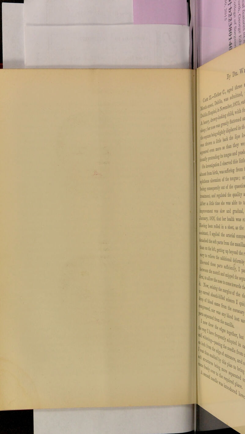 ✓ ^ flf & s S g r . ig t*i - f- fc, - 0 l r 0/ D& Wj ■ft. frjJ^'’ 7^mitted CaS£ „.vi;n. ffflS QipltS A®' t:|J ffll 1875,su1 rith fc at )) ~ -.pfltlv I ***?Ld*b back the l'Ps 101 more so1 and push I observed this littlt L from I ar beinj consequently out of the questioi tresmest and regulated the quality a ifier a lilt was si was st