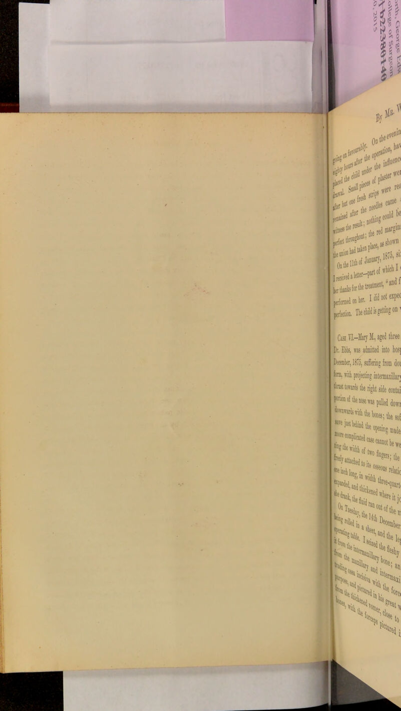 os 0,1 i t. i 1 * o o r; **% i ■m * By P Oo tbe ereo*n a{»T0UI .tioB: 1)8' fluent vd or <s>,,' ivoi were ref after1 tie n£ cam® «the^u,t;D W*U t. tie i in? COUW 1* ^ “and f j, I did not expel im The child is getting on1 Case VI.—Mary M., aged three LfcV, retail, Jw^dthele( ^ tie Hillary l * IK.JSWS *4v k>;> %>V>' X;.s p%d j