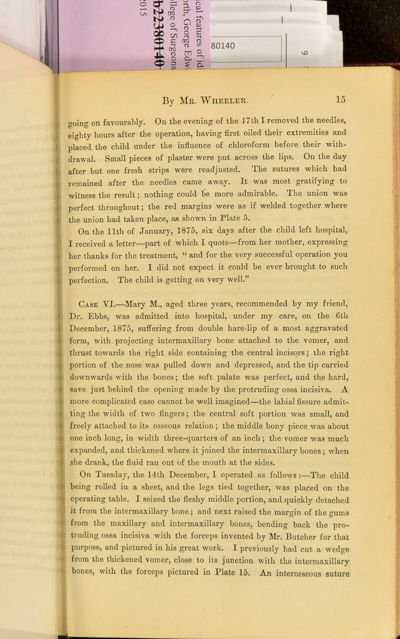 kO By Mr. Wiieeler. 15 going on favourably. On the evening of the 17th I removed the needles, eighty hours after the operation, having first oiled their extremities and placed the child under the influence of chloroform before their with- drawal. Small pieces of plaster were put across the lips. On the day after but one fresh strips were readjusted. The sutures which had remained after the needles came away. It was most gratifying to witness the result; nothing could be more admirable. The union was perfect throughout; the red margins were as if welded together where the union had taken place, as shown in Plate 5. On the 11th of January, 1875, six days after the child left hospital, I received a letter—part of which I quote—from her mother, expressing her thanks for the treatment, “ and for the very successful operation you performed on her. I did not expect it could be ever brought to such perfection. The child is getting on very well.” Case VI.—Mary M., aged three years, recommended by my friend, Dr. Ebbs, was admitted into hospital, under my care, on the 6th December, 1875, suffering from double hare-lip of a most aggravated form, with projecting intermaxillary bone attached to the vomer, and thrust towards the right side containing the central incisors; the right portion of the nose was pulled down and depressed, and the tip carried downwards with the bones; the soft palate was perfect, and the hard, save just behind the opening made by the protruding ossa incisiva. A more complicated case cannot be well imagined—the labial fissure admit- ting the width of two fingers; the central soft portion was small, and freely attached to its osseous relation ; the middle bony piece was about one inch long, in width three-quarters of an inch ; the vomer was much expanded, and thickened where it joined the intermaxillary bones; when she drank, the fluid ran out of the mouth at the sides. On Tuesday, the 14th December, I operated as follows:—The child being rolled in a sheet, and the legs tied together, was placed on the operating table. I seized the fleshy middle portion, and quickly detached it from the intermaxillary bone; and next raised the margin of the gums from the maxillary and intermaxillary boues, bending back the pro- truding ossa incisiva with the forceps invented by Mr. Butcher for that purpose, and pictured in his great work. I previously had cut a wedge | from the thickened vomer, close to its junction with the intermaxillary