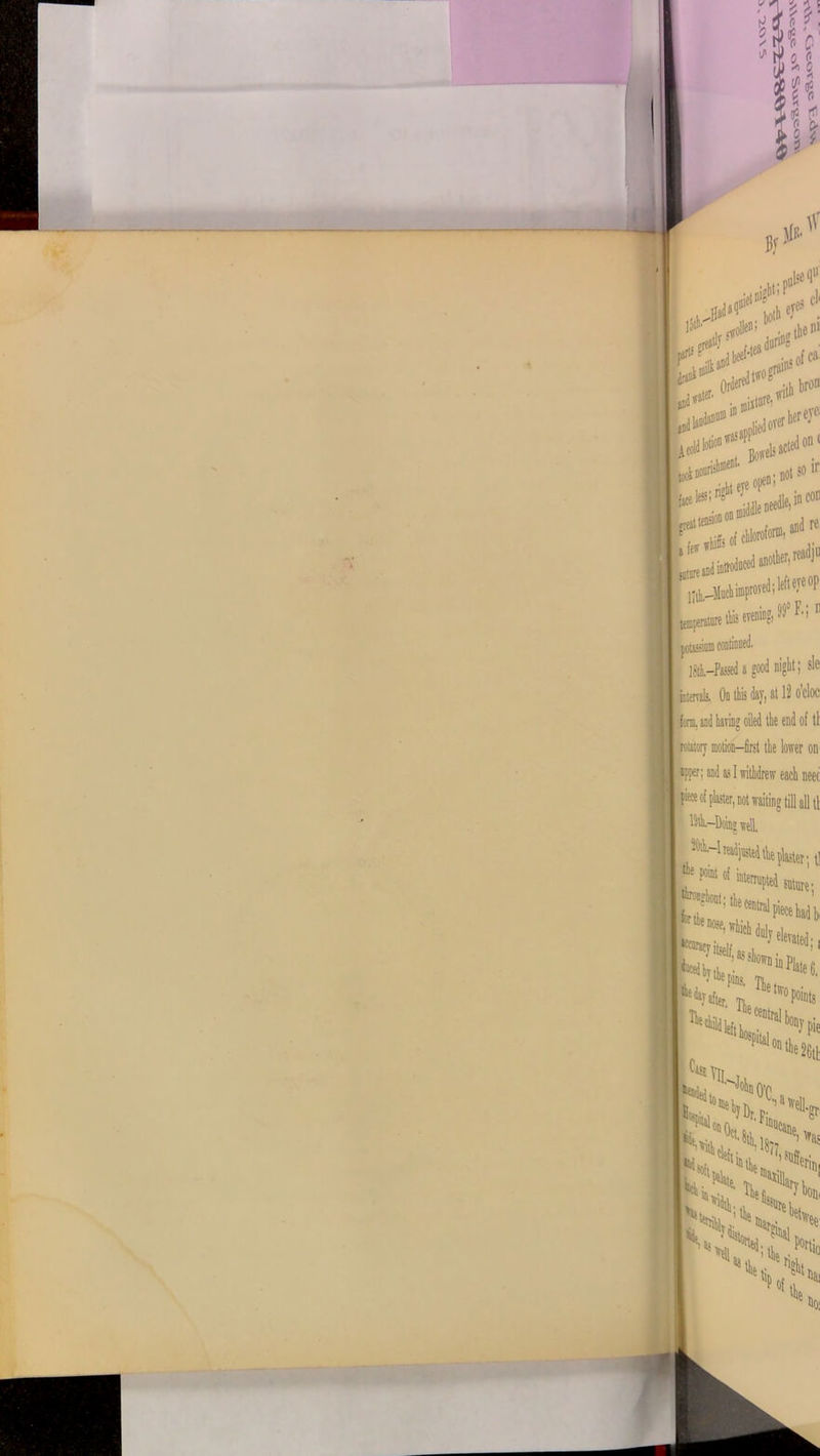 ..U'DUlseqU effs d U*1’ udUrt' F{SI _ , .u^fnnn, andre a fe»1 > this evening, 99° F.; ii jat-Passed a good night; s!e icterrels. On this day, od® watery motion—first the lower on upper; and as I withdrew each neet interrupted sattire- i i The c ! >K'0 Dnin **«!2 ei >as >^3utl,in sft t: sc kscs lie