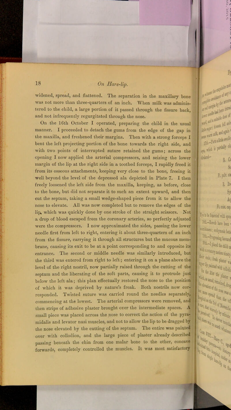 widened, spread, and flattened. The separation in the maxillary bone was not more than three-quarters of an inch. When milk was adminis- tered to the child, a large portion of it passed through the fissure back, and not infrequently regurgitated through the nose. On the 16th October I operated, preparing the child in the usual manner. I proceeded to detach the gums from the edge of the gap in the maxilla, and freshened their margins. Then with a strong forceps I bent the left projecting portion of the bone towards the right side, and with two points of interrupted suture retained the gums; across the opening I now applied the arterial compressors, and seizing the lower margin of the lip at the right side in a toothed forceps, I rapidly freed it from its osseous attachments, keeping very close to the bone, freeing it well beyond the level of the depressed ala depicted in Plate 7. I then freely loosened the left side from the maxilla, keeping, as before, close to the bone, but did not separate it to such an extent upward, and then cut the septum, taking a small wedge-shaped piece from it to allow the nose to elevate. All was now completed but to remove the edges of the lip, which was quickly done by one stroke of the straight scissors. Not a drop of blood escaped from the coronary arteries, so perfectly adjusted were the compi-essors. I now approximated the sides, passing the lower needle first from left to right, entering it about three-quarters of an inch from the fissure, carrying it through all structures but the mucous mem- brane, causing its exit to be at a point corresponding to and opposite its entrance. The second or middle needle was similarly introduced, but the third was entered from right to left; entering it on a plane above the level of the right nostril, now partially raised through the cutting of the septum and the liberating of the soft parts, causing it to protrude just below the left ala; this plan effectually restored the nose to the position of which it was deprived by nature’s freak. Both nostrils now cor- responded. Twisted suture was carried round the needles separately, commencing at the lowest. The arterial compressors were removed, and then strips of adhesive plaster brought over the intermediate spaces. A small piece was placed across the nose to correct the action of the pyra- midalis and levator nasi muscles, and not to allow the lip to be dragged by the nose elevated by the cutting of the septum. The entire was painted over with collodion, and the large piece of plaster already described passing beneath the chin from one malar bone to the other, concave forwards, completely controlled the muscles. It was most satisfactory Ft, mist, cap, Eje to be fomented with spon hiL-Bowels lave been' Boniiment; ecchymosis betti 15i~%Ksin»{av01tai