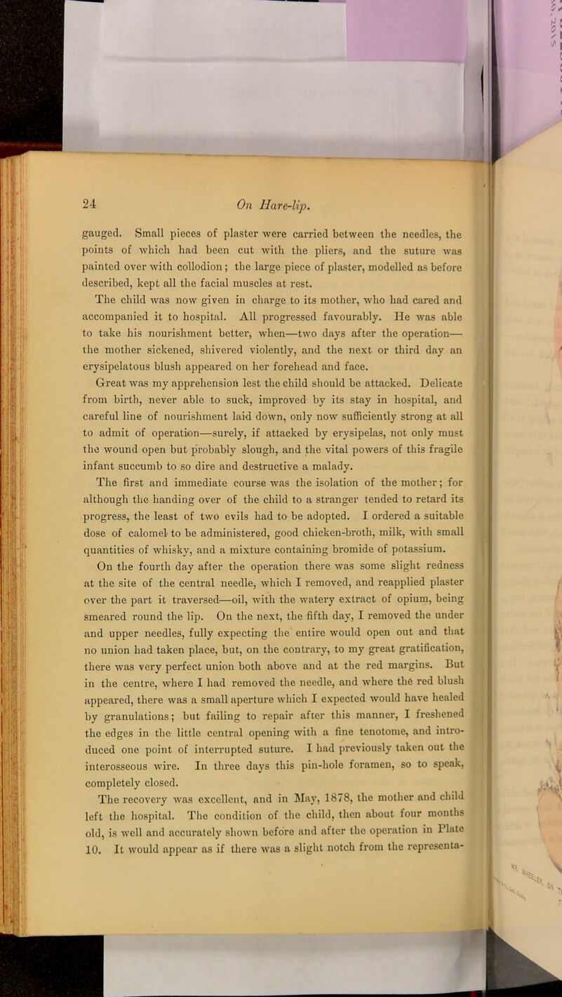 gauged. Small pieces of plaster were carried between the needles, the points of which had been cut with the pliers, and the suture was painted over with collodion ; the large piece of plaster, modelled as before described, kept all the facial muscles at rest. The child was now given in charge to its mother, who had cared and accompanied it to hospital. All progressed favourably. He was able to take his nourishment better, when—two days after the operation— the mother sickened, shivered violently, and the next or third day an erysipelatous blush appeared on her forehead and face. Great was my apprehension lest the child should be attacked. Delicate from birth, never able to suck, improved by its stay in hospital, and careful line of nourishment laid down, only now sufficiently strong at all to admit of operation—surely, if attacked by ei’ysipelas, not only must the wound open but probably slough, and the vital powers of this fragile infant succumb to so dire and destructive a malady. The first and immediate course was the isolation of the mother; for although the handing over of the child to a stranger tended to retard its progress, the least of two evils had to be adopted. I ordered a suitable dose of calomel to be administered, good chicken-broth, milk, with small quantities of whisky, and a mixture containing bromide of potassium. On the fourth day after the operation there was some slight redness at the site of the central needle, which I removed, and reapplied plaster over the part it traversed—oil, with the watery extract of opium, being smeared round the lip. On the next, the fifth day, I removed the under and upper needles, fully expecting the entire would open out and that no union had taken place, but, on the contrary, to my great gratification, there was very perfect union both above and at the red margins. But in the centre, where I had removed the needle, and where the red blush appeared, there was a small aperture which I expected would have healed by granulations; but failing to repair after this manner, I freshened the edges in the little central opening with a fine tenotome, and intro- duced one point of interrupted suture. I had previously taken out the interosseous wire. In three days this pin-hole foramen, so to speak, completely closed. The recovery was excellent, and in May, 1878, the mother and child left the hospital. The condition of the child, then about four months old, is well and accurately shown before and after the operation in Plate 10. It would appear as if there was a slight notch from the representa-