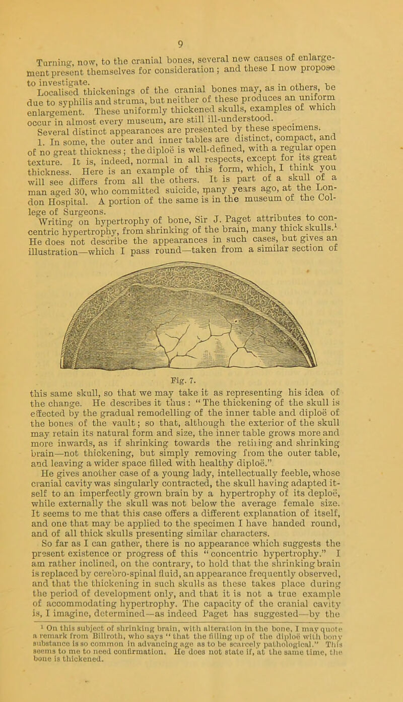 Tuniino', now, to the cranial bones, several new causes of enlarge- ment present themselves for consideration ; and these I now propose *°Local?sed*^tiiickenings of the cranial bones may, as in others, be due to syphilis and struma, but neither of these produces an enlargement. These uniformly thickened skulls, examples or which occur in almost every museum, are still ill-understood. Several distinct appearances are presented by these specimens. 1. In some, the outer and inner tables are distinct, compact, and of no great thickness; the diploe is well-defined, with a regular open texture. It is, indeed, normal in all respects, except for its great thickness. Here is an example of this form, which, I you will see differs from all the others. It is part of a skull of a man aged 30, who committed suicide, ipany years ago, at tPe J^on- don Hospital. A portion of the same is in the museum ot the Col- lege of Surgeons. ^ . Writing on hypertrophy of bone. Sir J. Paget attributes to con- centric hypertroph}', from shrinking of the brain, many wick skulls. He does not describe the appearances in such cases, but gives an illustration—which I pass round—taken from a similar section ot Fig. 7. this same skull, so that we may take it as representing his idea of the change. He describes it thus : “ The thickening of the skull is eSected by the gradual remodelling of the inner table and diploe of the bones of the vault; so that, although the exterior of the skull may retain its natural form and size, the inner table grows more and more inwards, as if shrinking towards the retiring and shrinking brain—not thickening, but simply removing from the outer table, and leaving a wider space filled with healthy diploe.” He gives another case of a young lady, intellectually feeble, whose cranial cavity was singularly contracted, the skull having adapted it- self to an imperfectly grown brain by a hypertrophy of its deploe, while externally the skull was not below the average female size. It seems to me that this case offers a different explanation of itself, and one that may be applied to the specimen I have handed round, and of all thick skulls presenting similar chai’acters. So far as I can gather, there is no appearance which suggests the present existence or progress of this “ concentric hypertrophy.” I am rather inclined, on the contrary, to hold that the shrinking brain is replaced by cere’oro-spinal fluid, an appearance frequently observed, and that the thickening in such skulls as these takes place during the period of development only, and that it is not a true example of accommodating hypertrophy. The capacity of the cranial cavity is, I imagine, determined—as indeed Paget has suggested—by the ' Oil tins subject of shriiikiiig brain, with alterntion in the bone. I may quote a remark from Biliroth, who says “ that tlio liliing up of the diploo witii bony aiibstanco is so common in advancing ago as to be scarcely patliological.” This seems to me to need coniirmatioa. Ho does not state if, at the same lime, the bone is thickened.